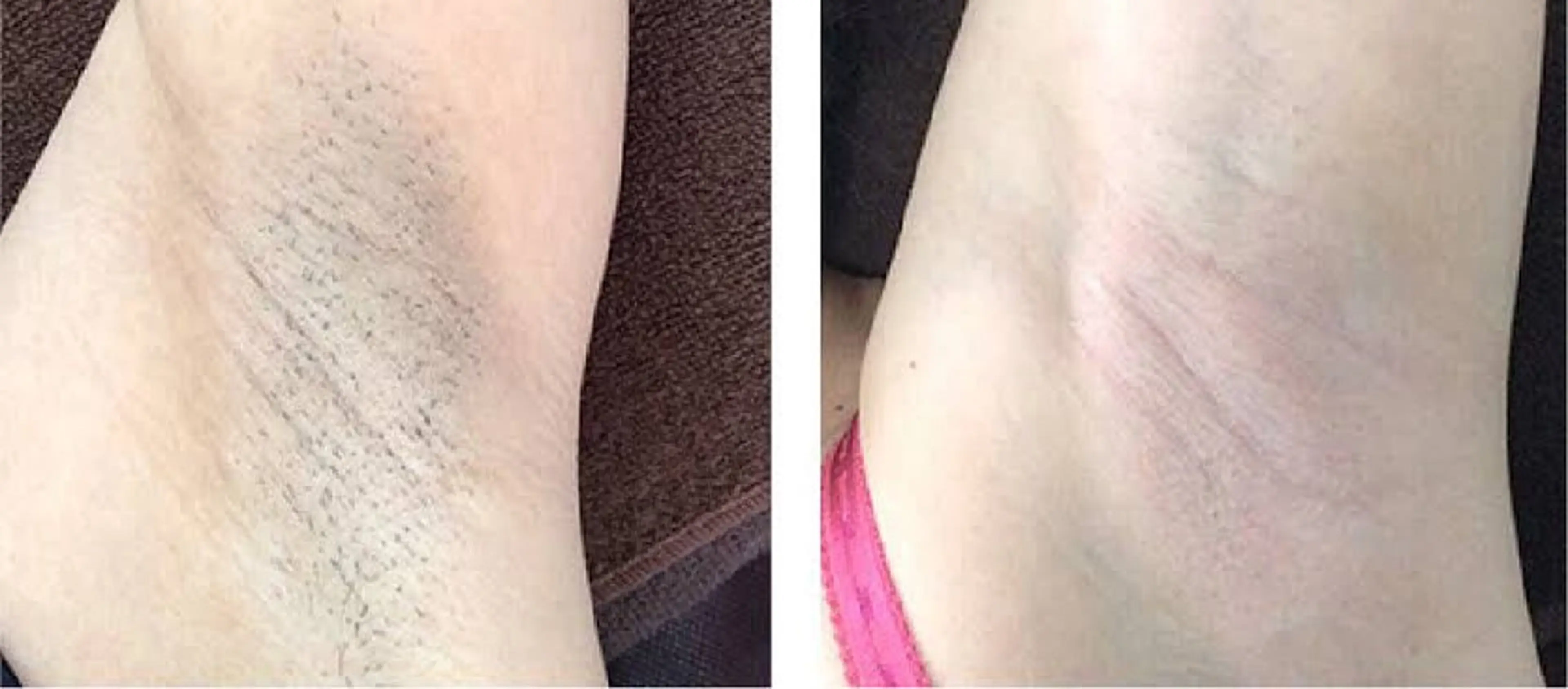 脱毛 脱毛&フェイシャル 専門店muro.のエステ・リラクイメージ