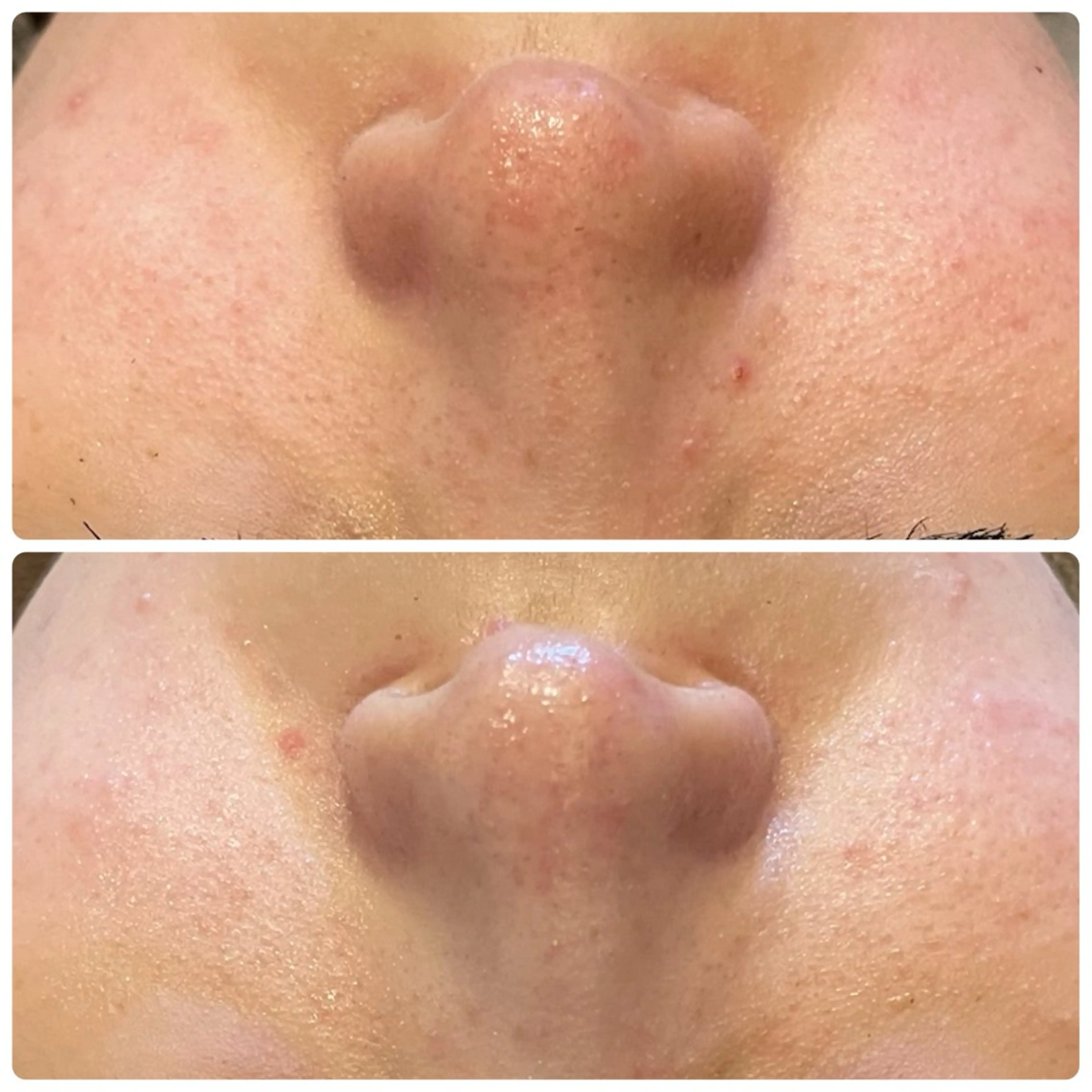 エステ yellow.所属・yellow💛【 脱毛&フェイシャル】のエステ・リラクイメージ