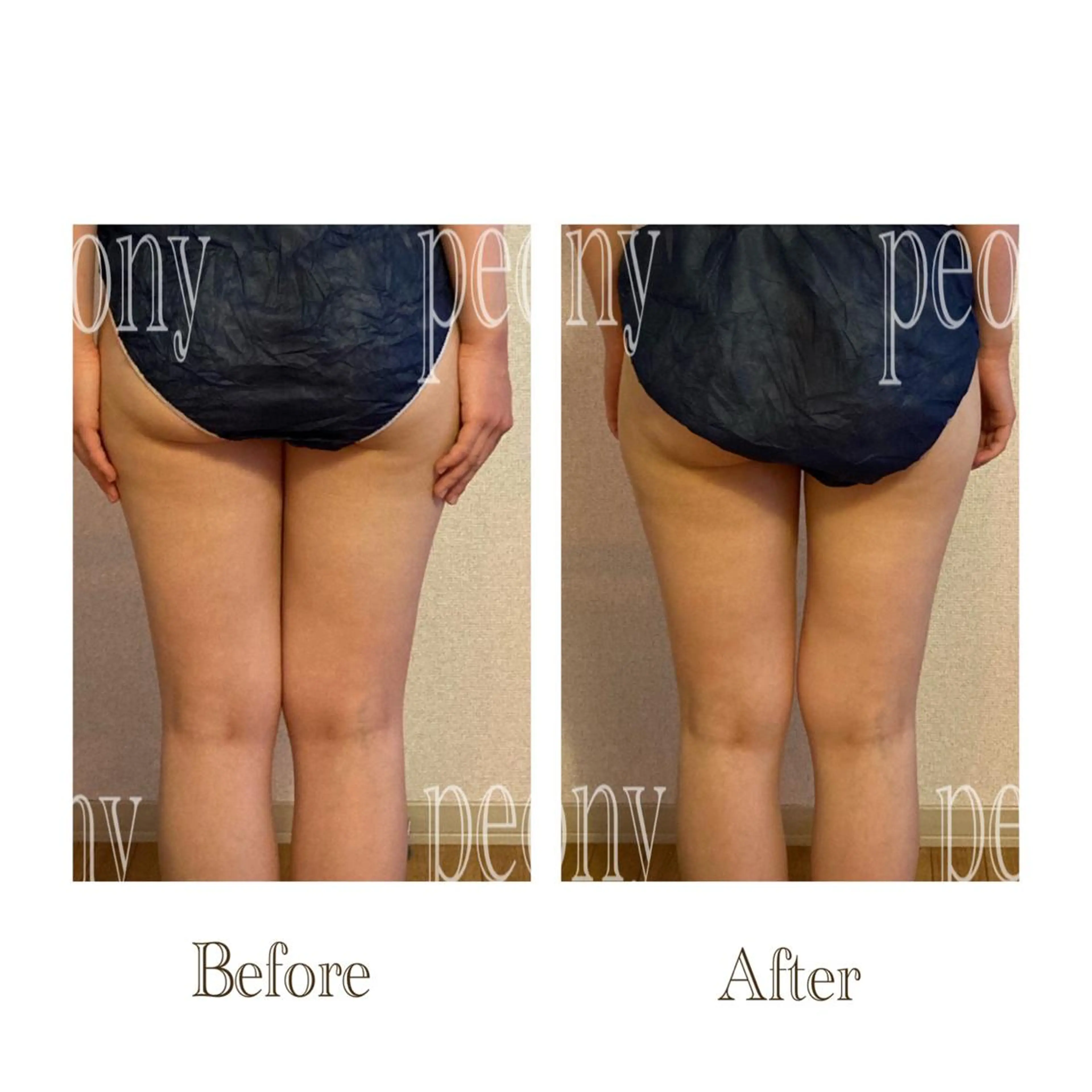 エステ デトックス美容専門サロンｐｅｏｎｙ所属・デトックス美容専門 サロンｐｅｏｎｙのエステ・リラクイメージ