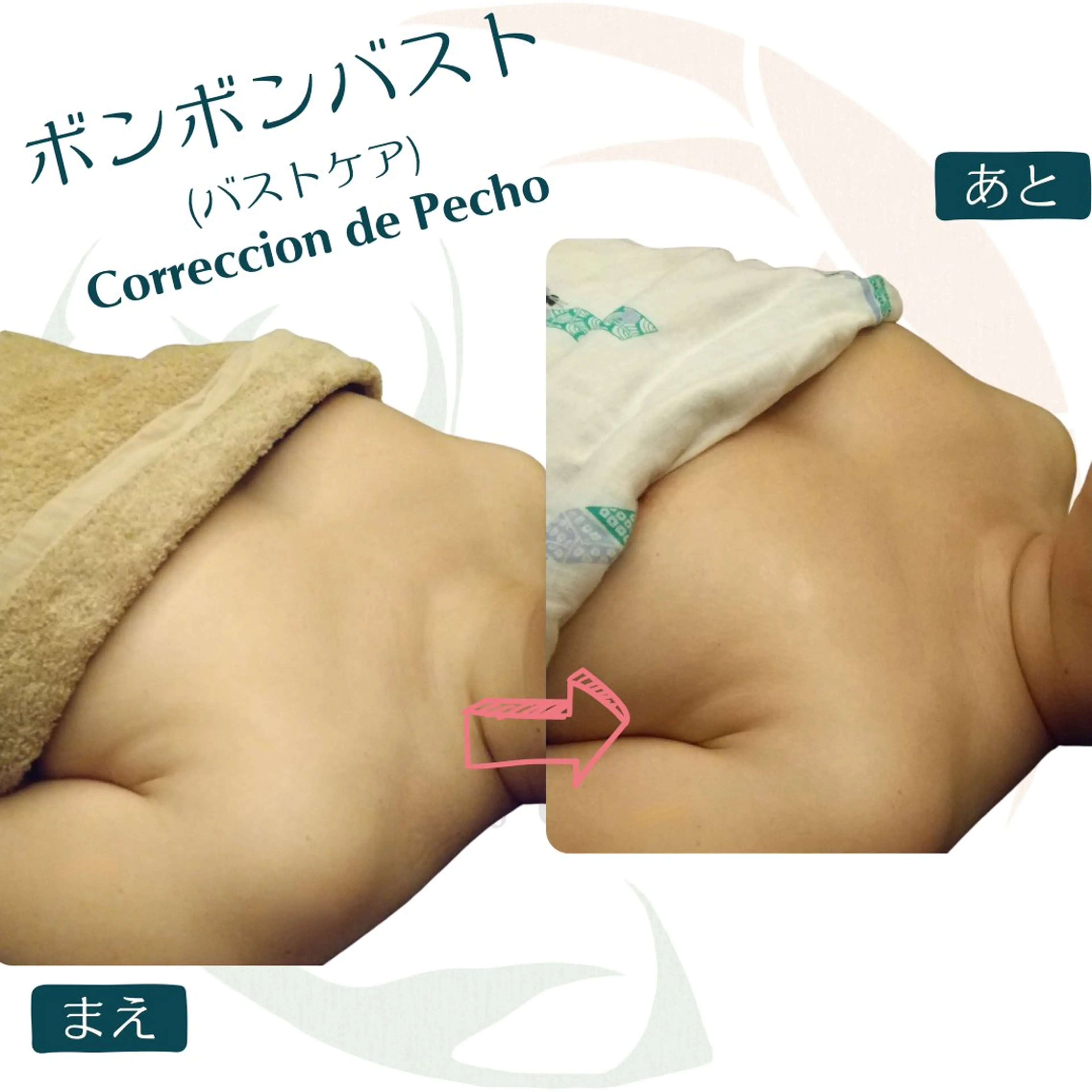 小顔矯正☀︎バスト ☀︎ハルのエステ・リラクイメージ