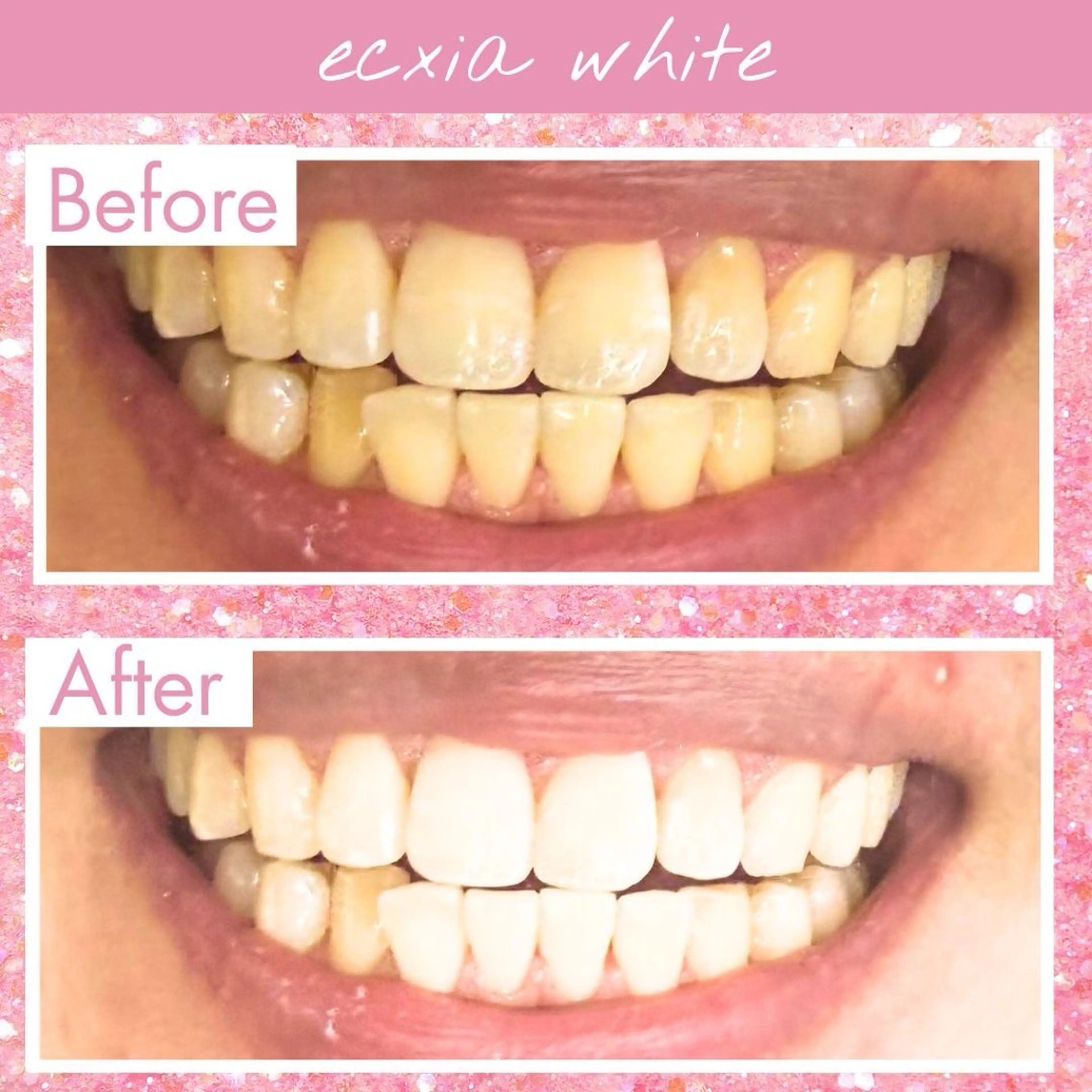 エクシア仙台駅東口店所属・セルフホワイトニング エクシア仙台駅東口店のその他イメージ