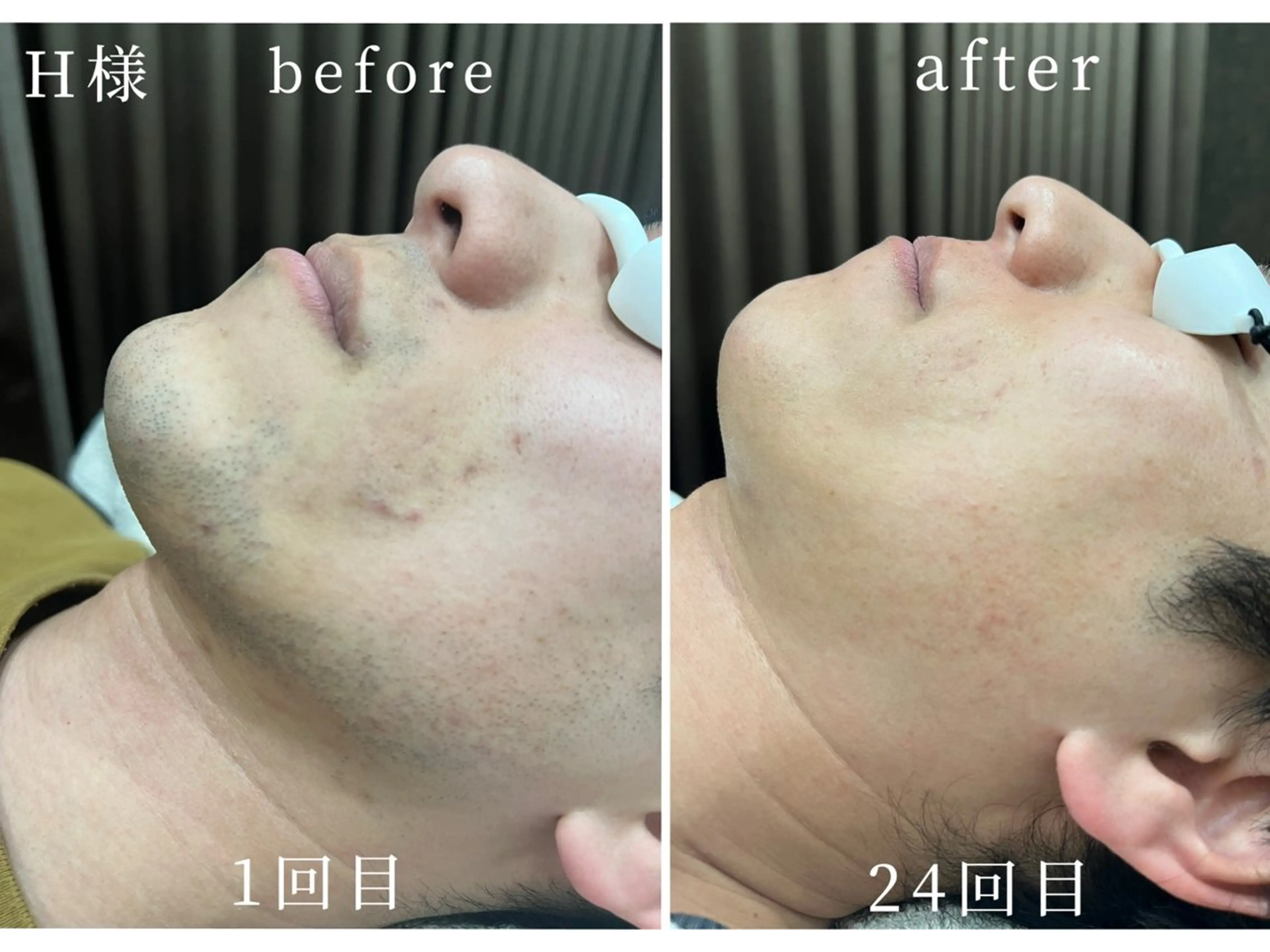 脱毛 Hair Peace-脱毛サロン-所属・Hair Peace 脱毛サロンのエステ・リラクイメージ