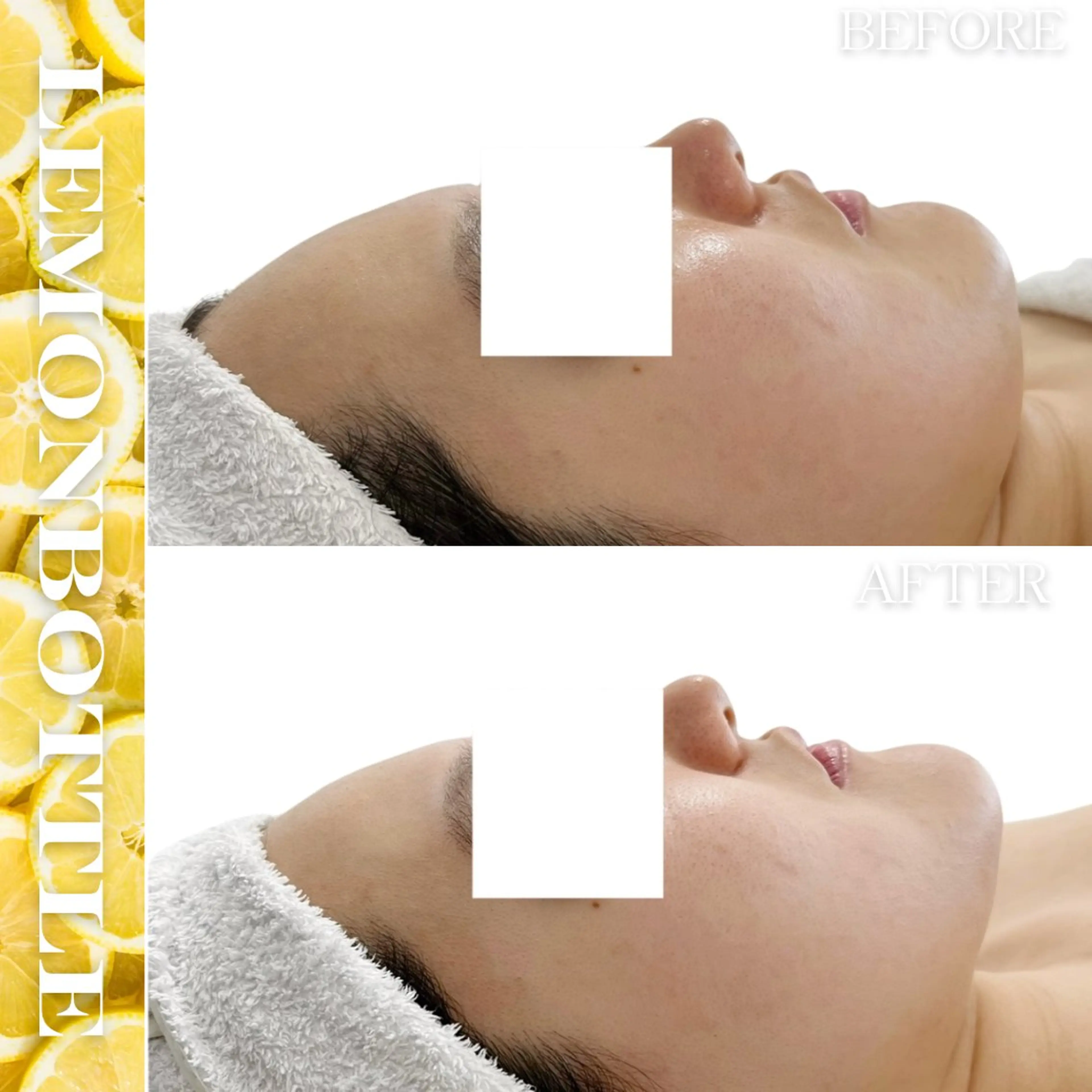 その他 Liam《美肌管理/ 3D小顔/脂肪ケア》のエステ・リラクイメージ