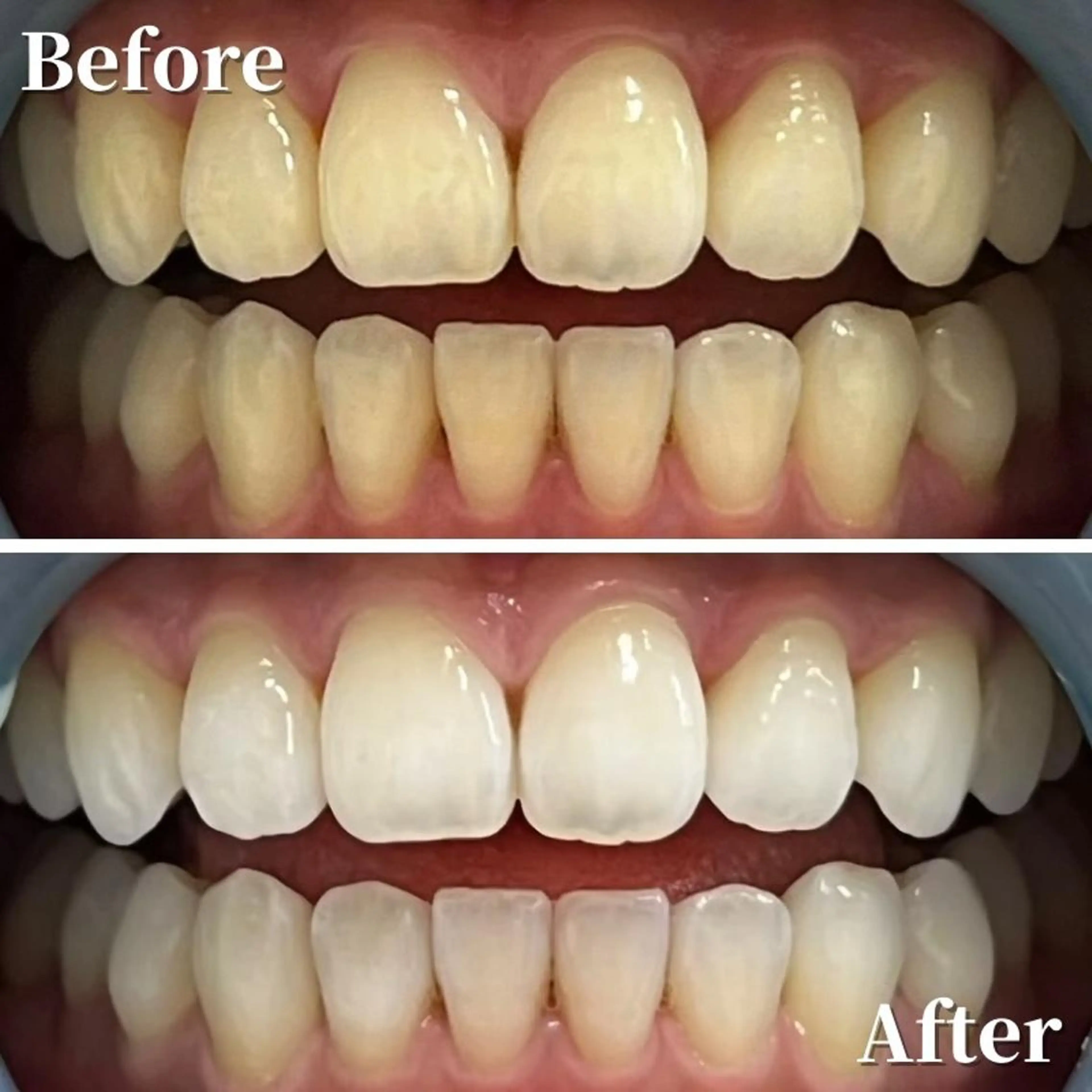 LBSホワイトニング 銀座店💎店長浦和のその他イメージ