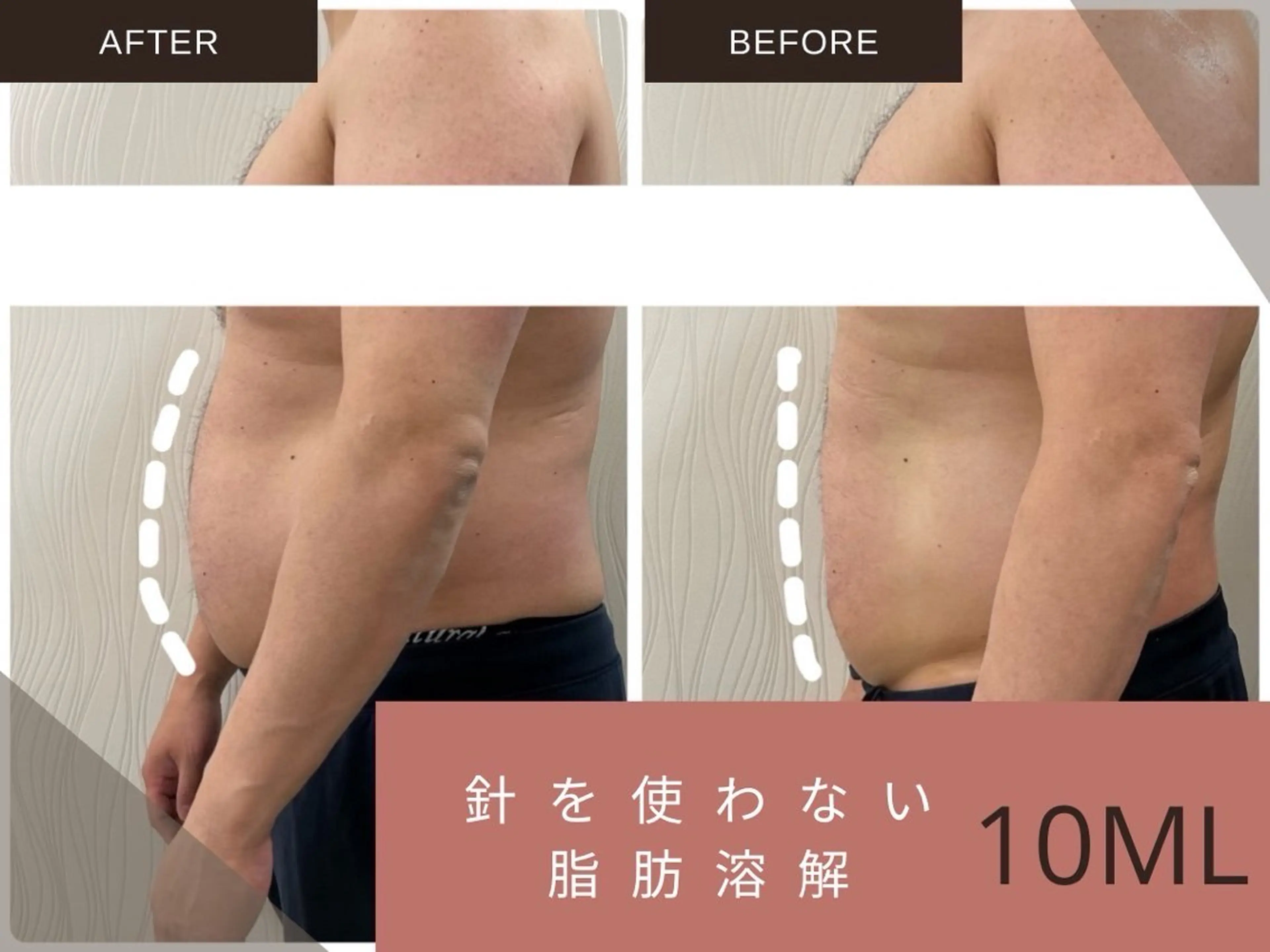 痩身・リラク KOZUEのエステ・リラクイメージ