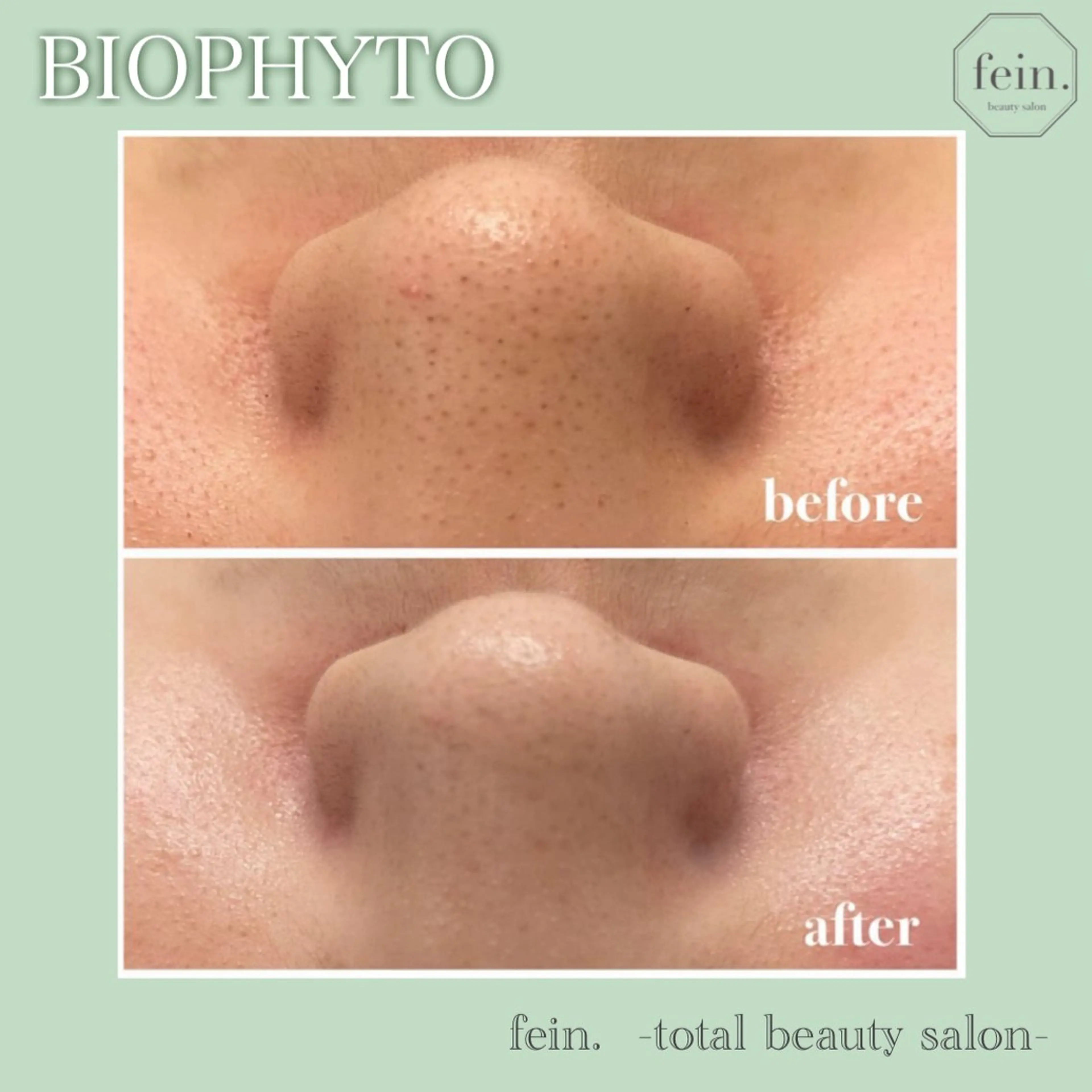 エステ 🦋美肌サロン. maho🦋のエステ・リラクイメージ