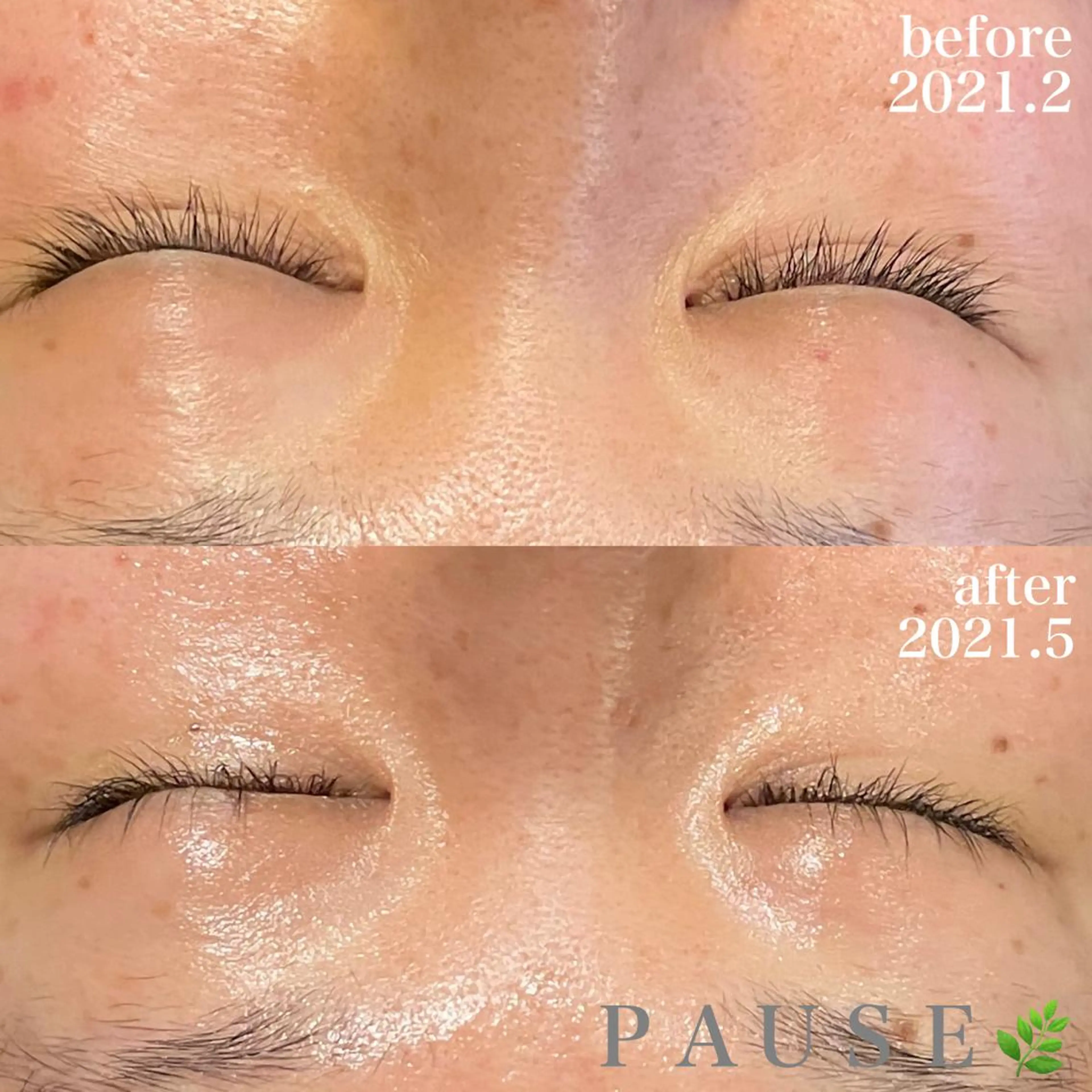 エステ 浜野 恵美のエステ・リラクイメージ