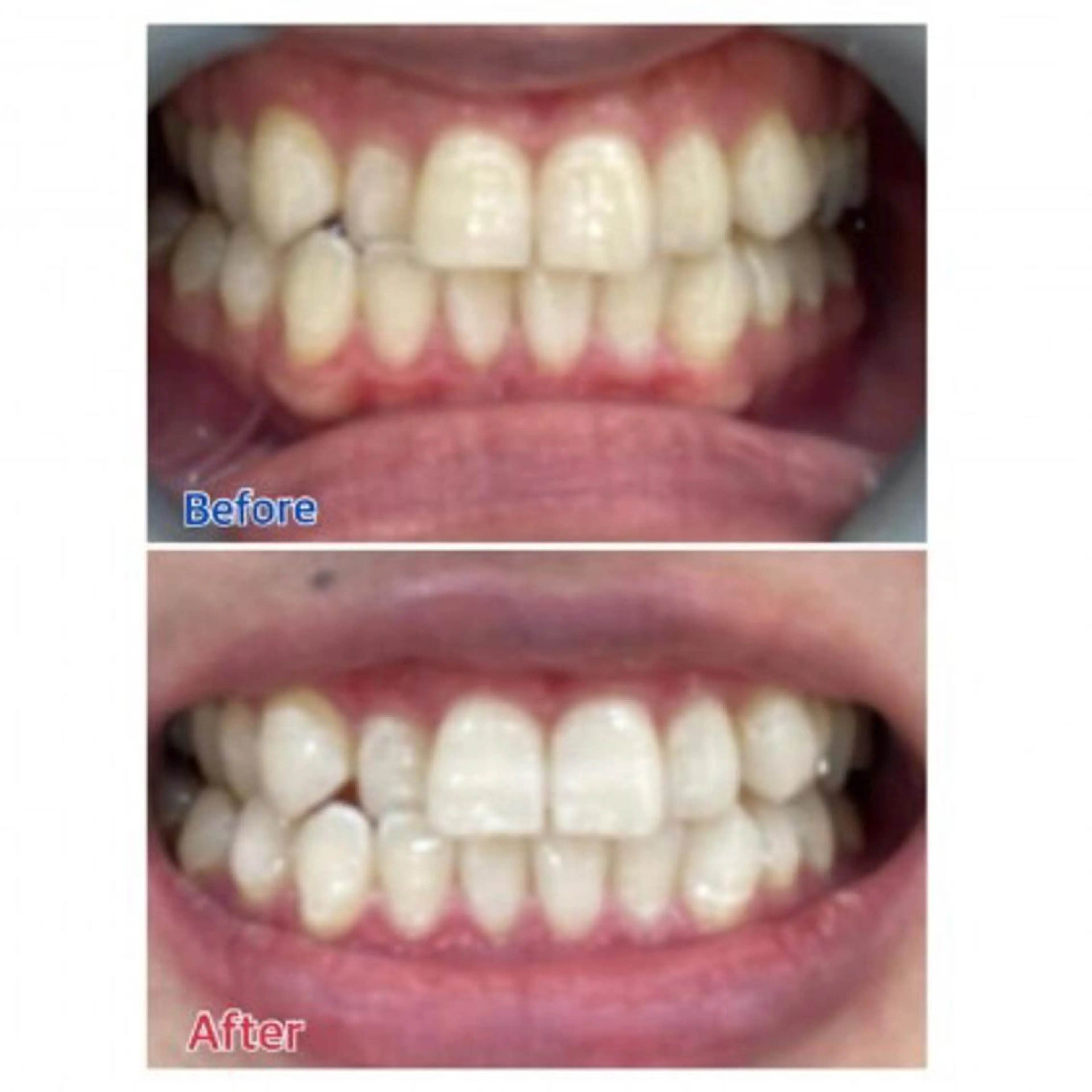 M渋谷店所属・Ｍ渋谷 ホワイトニングのエステ・リラクイメージ