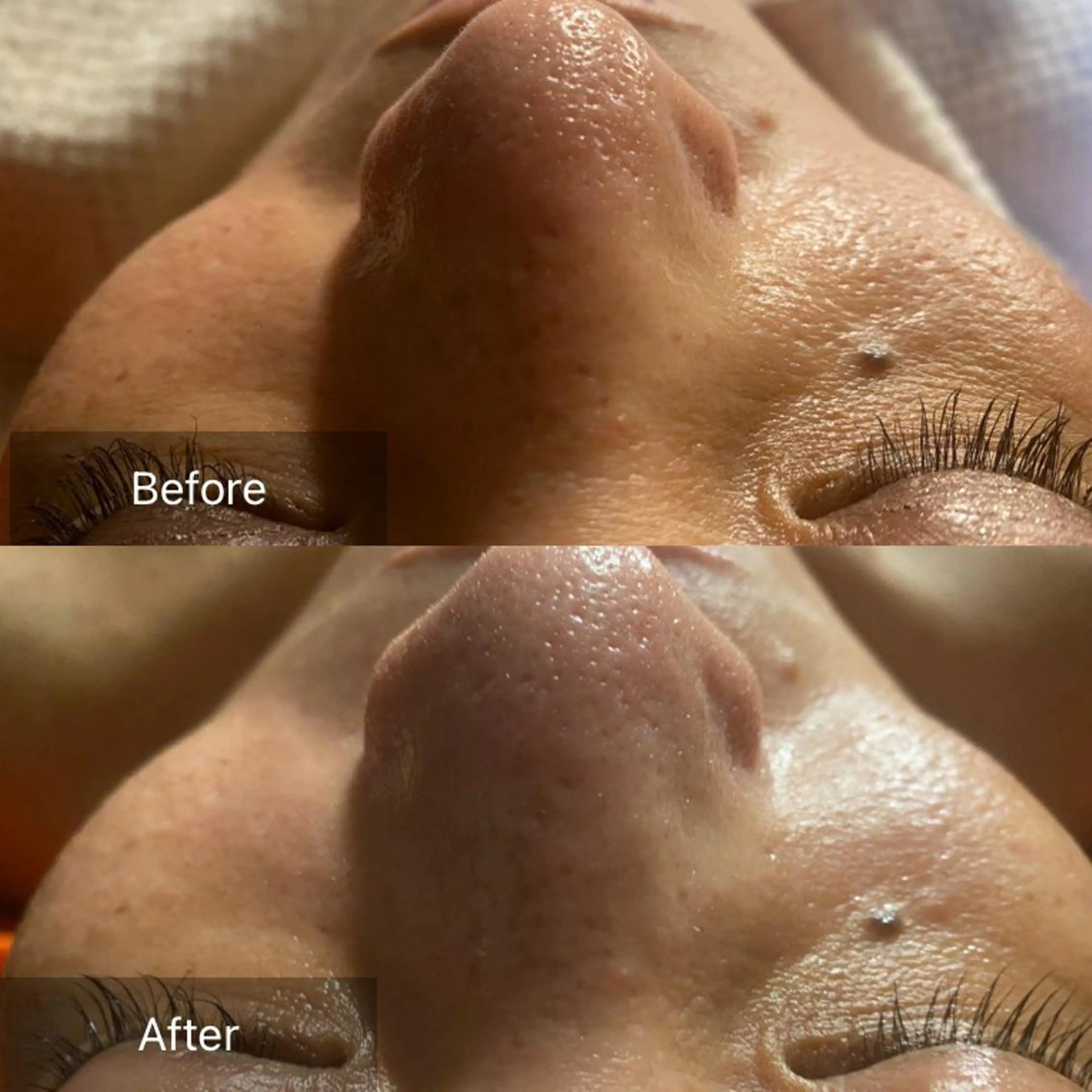 Mandarin Orange所属・毛穴から始める肌メン テマンダリンオレンジのエステ・リラクイメージ