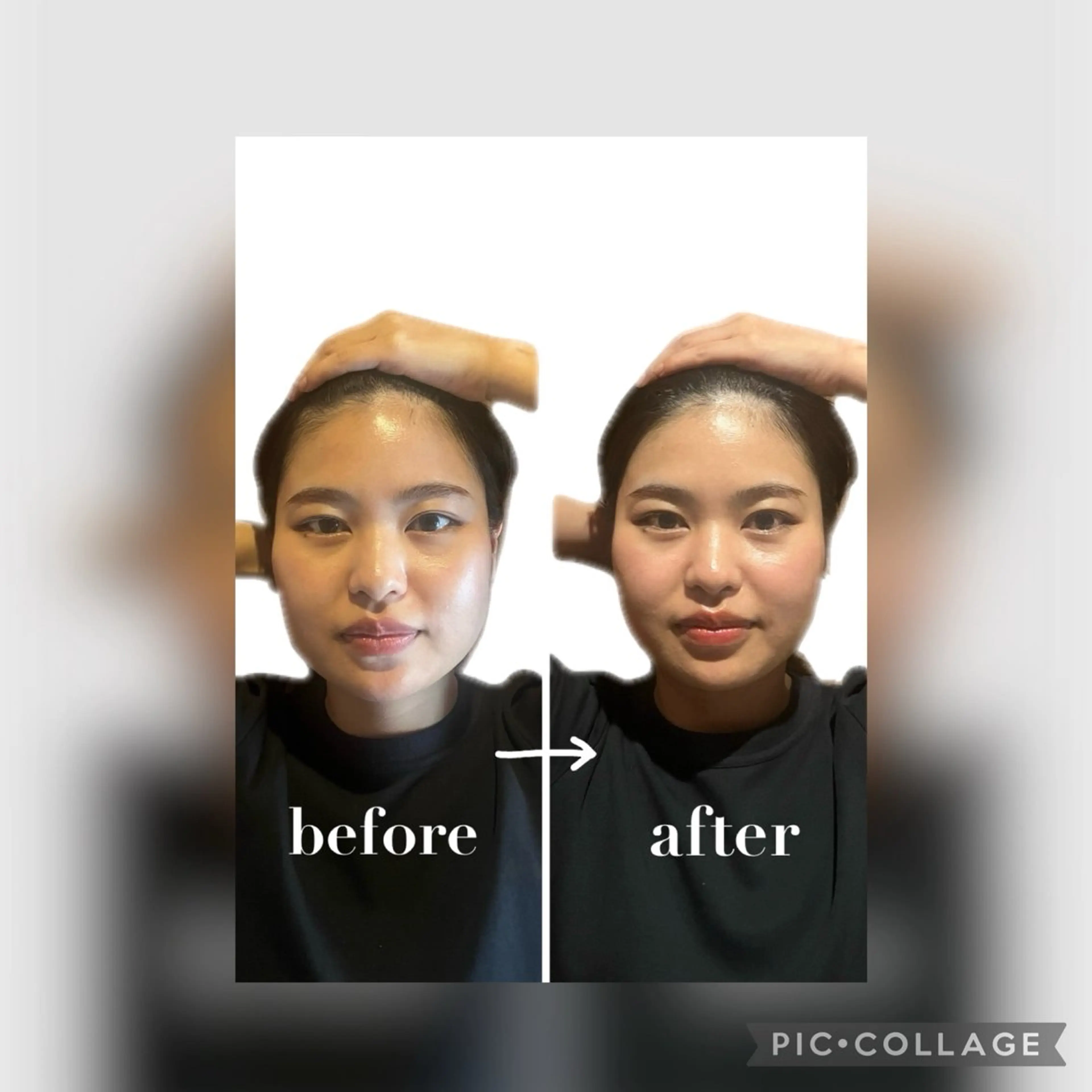 【単品メニュー】エラ調整の写真