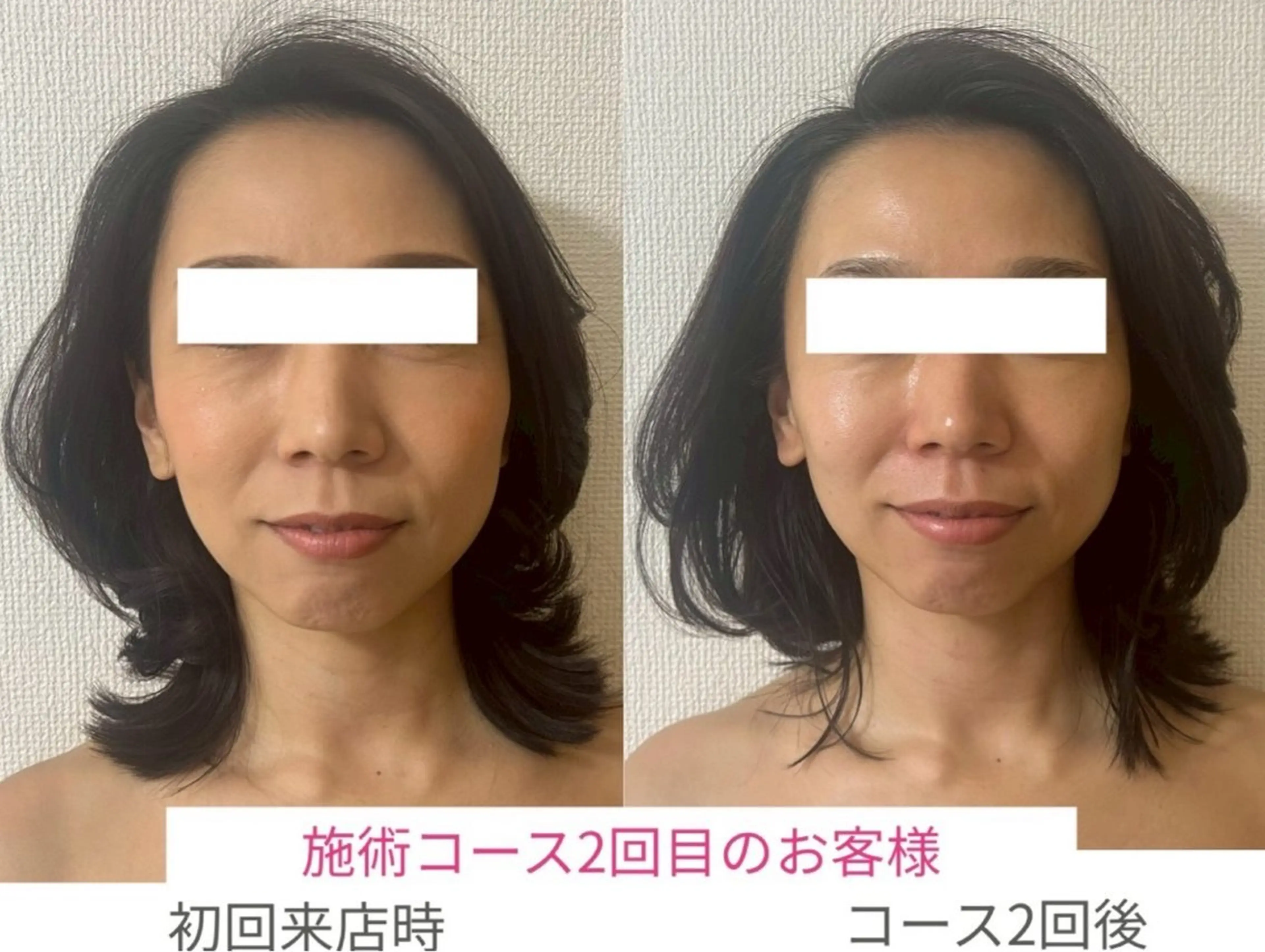 エステ la lumie're (ラ リュミエール)所属・小顔サロン (ラ リュミエール)のエステ・リラクイメージ