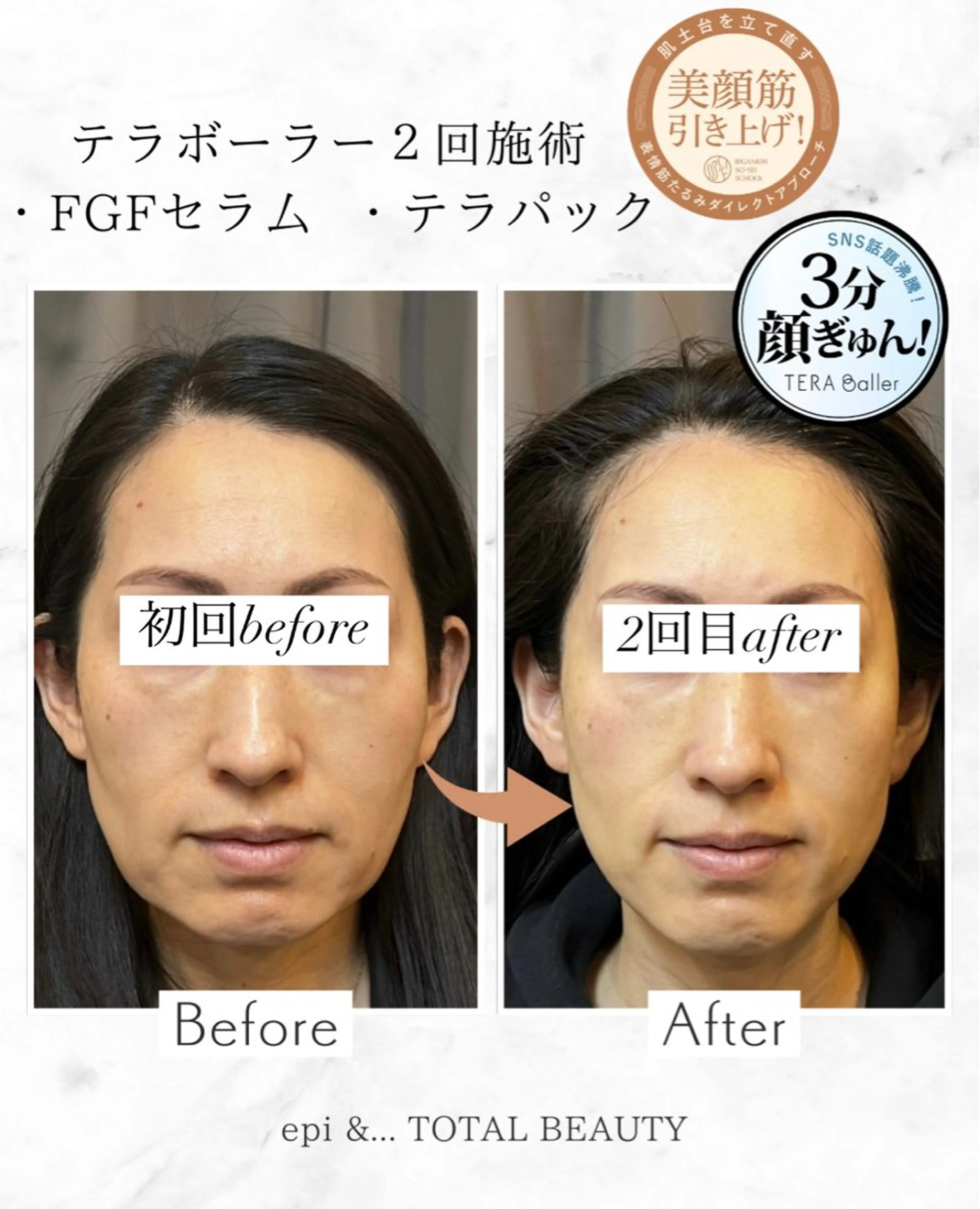 epi &... TOTAL BEAUTY所属・epi &... Harukaのエステ・リラクイメージ