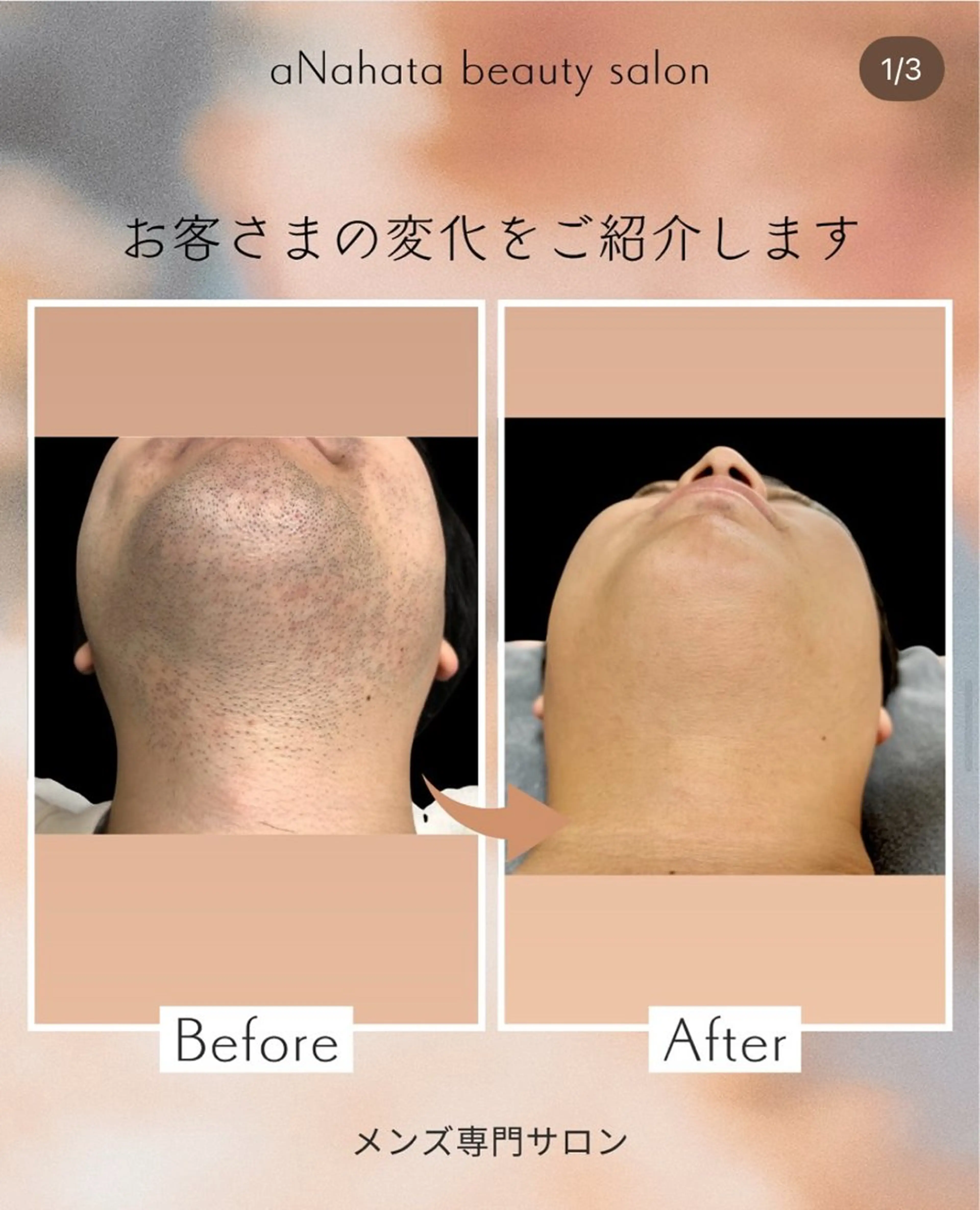 メンズ aNahata beauty salon所属・田中 菜月のエステ・リラクイメージ