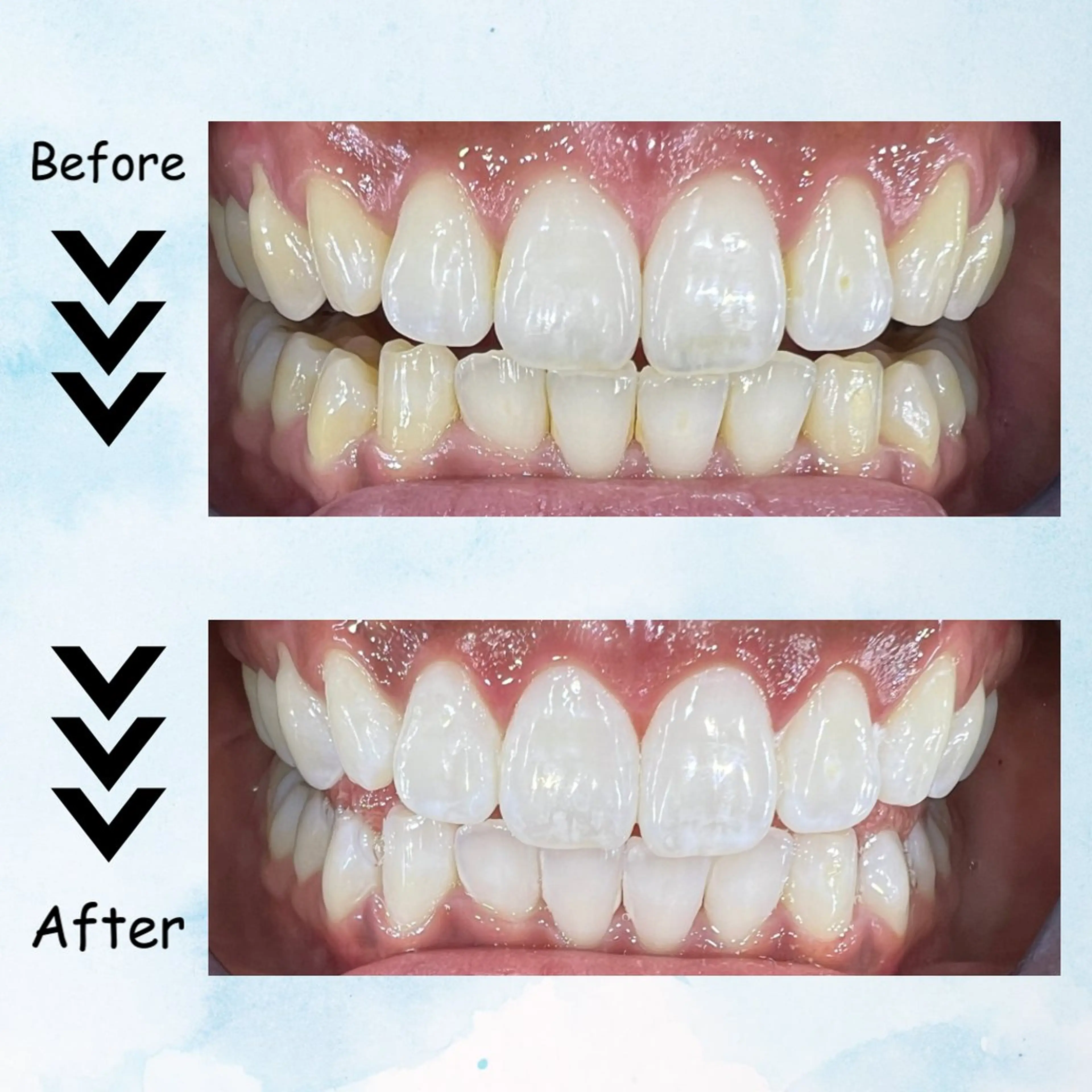 マツエク・マツパ その他 セルフホワイトニング エクシア塩釜口駅前店所属・セルフホワイトニング エクシア塩釜口駅前店のその他イメージ