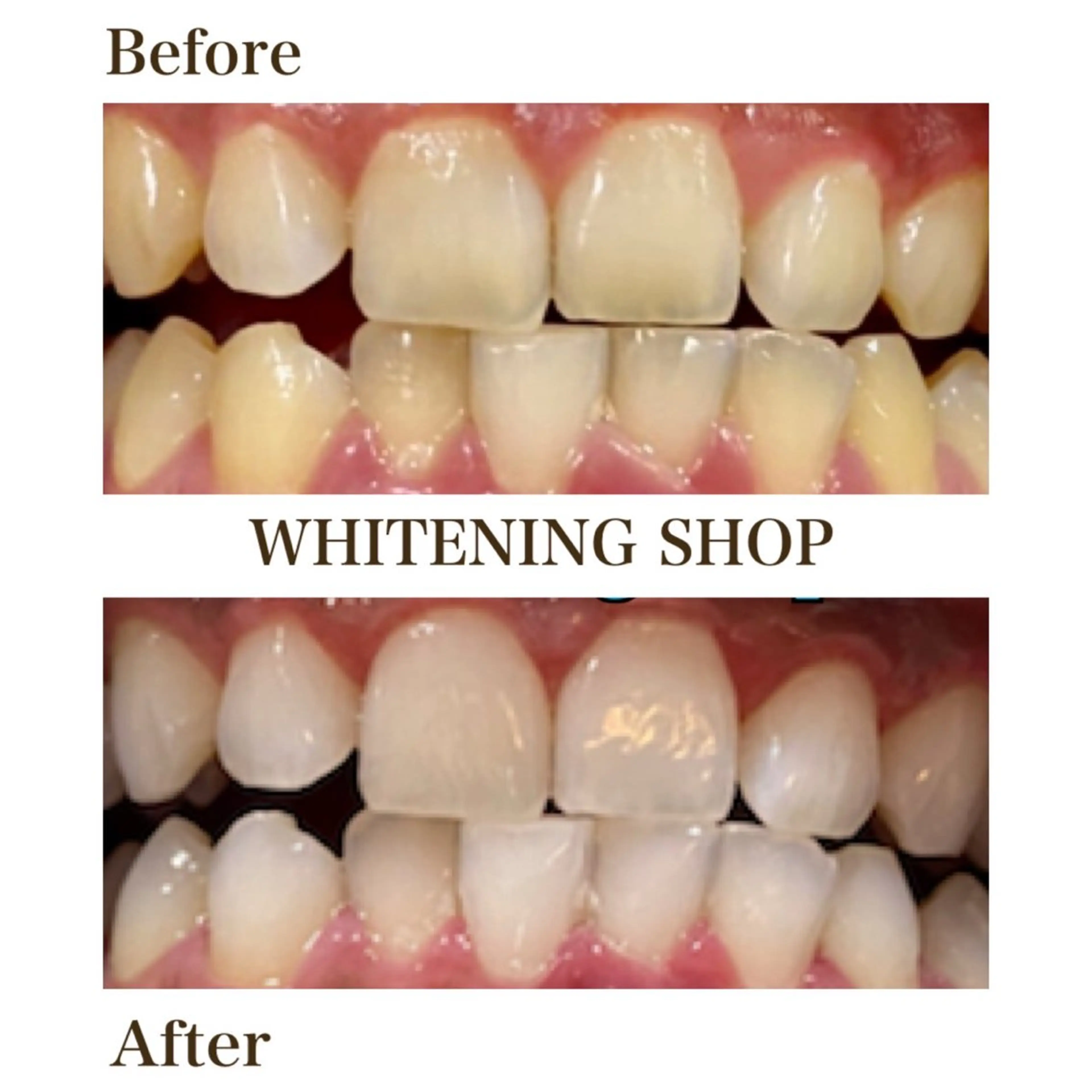 メンズ エステ リラク ホワイトニング ショップ川越店のエステ・リラクイメージ