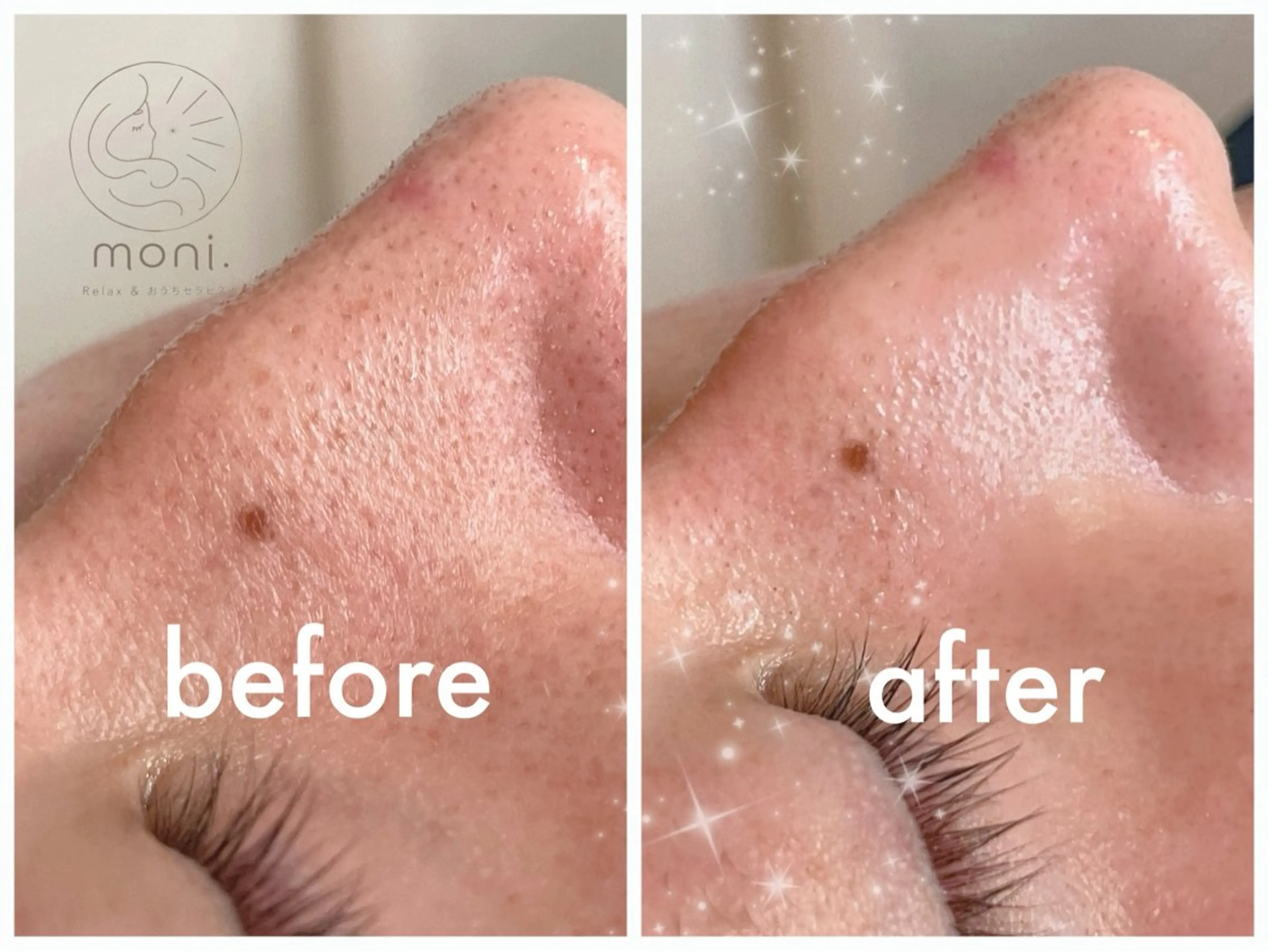 🌿肌質改善 ×美顔ケア💫⟡.のエステ・リラクイメージ