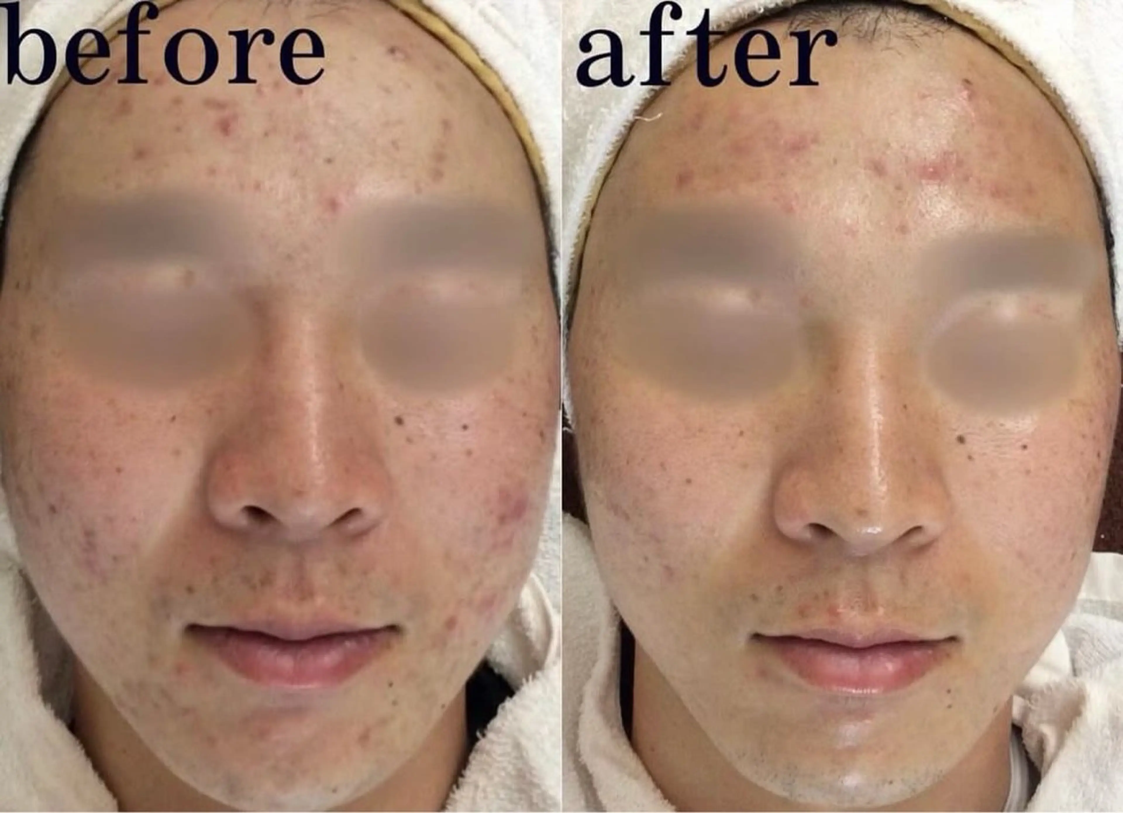 エステ Salon de Bis所属・サロン ド ビス 髙橋美月のエステ・リラクイメージ