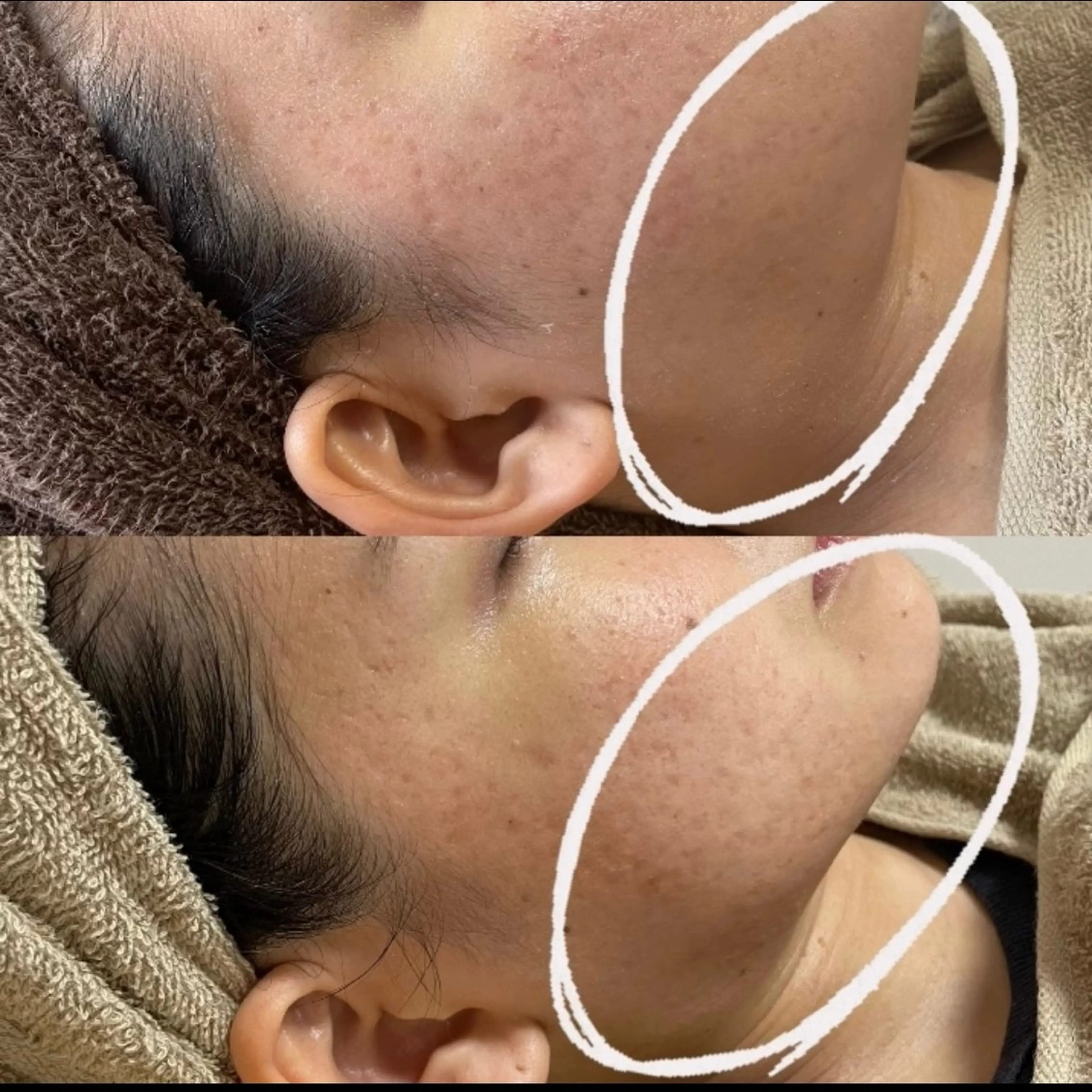 エステ プライベートサロン Belle（ベル）のエステ・リラクイメージ