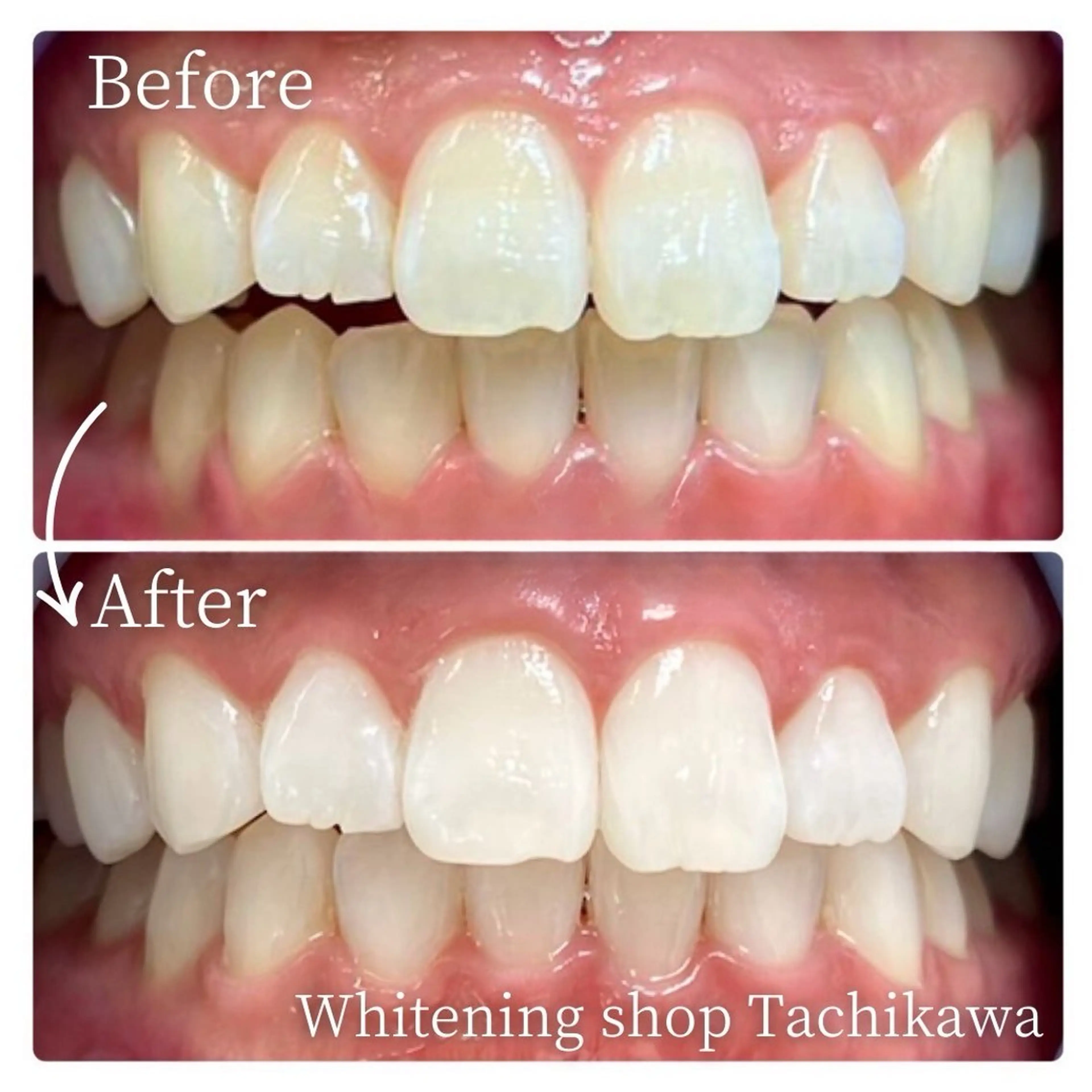 セルフ ホワイト ニングショップ立川のその他イメージ