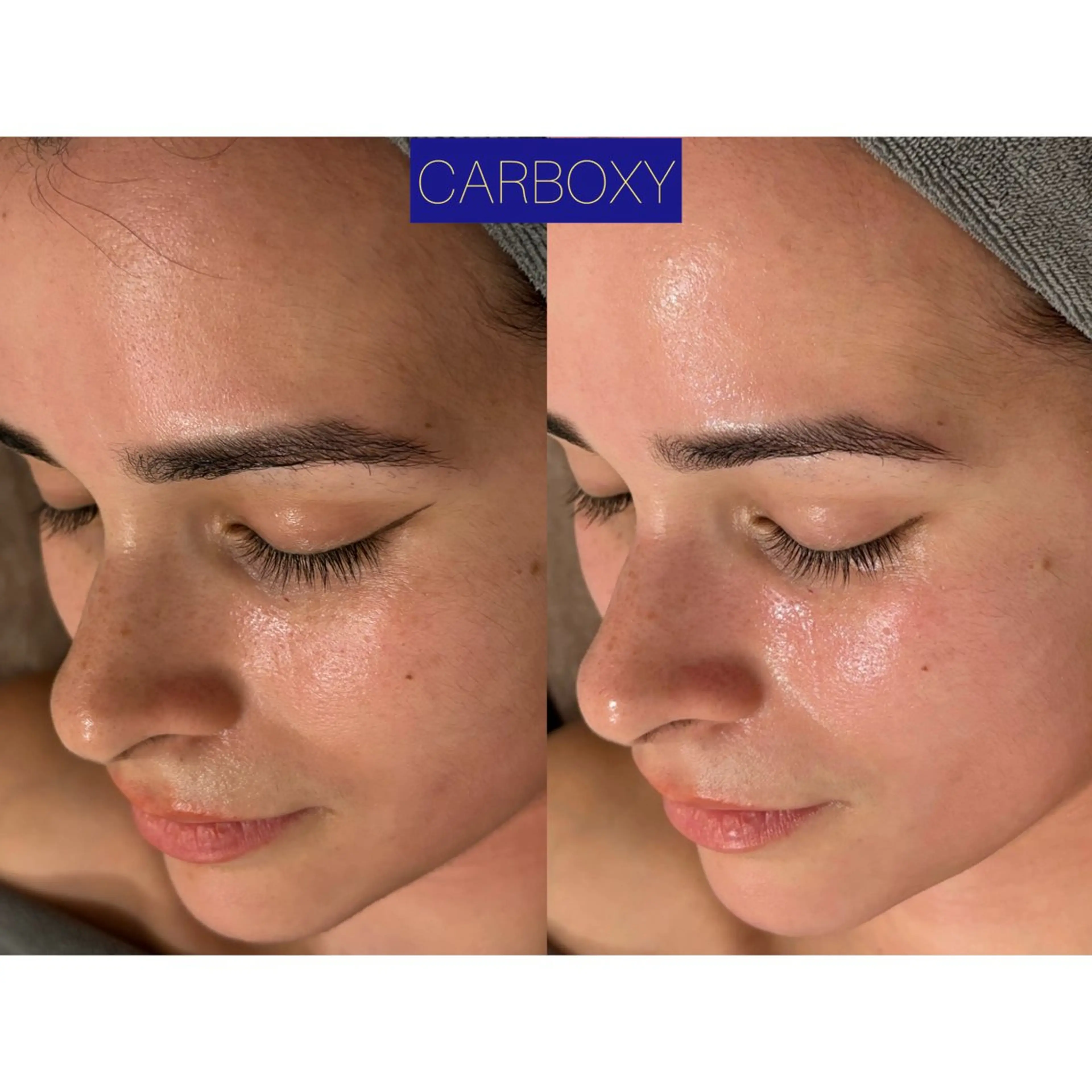 その他 ☆痩身/小顔☆ コルギのエステ・リラクイメージ