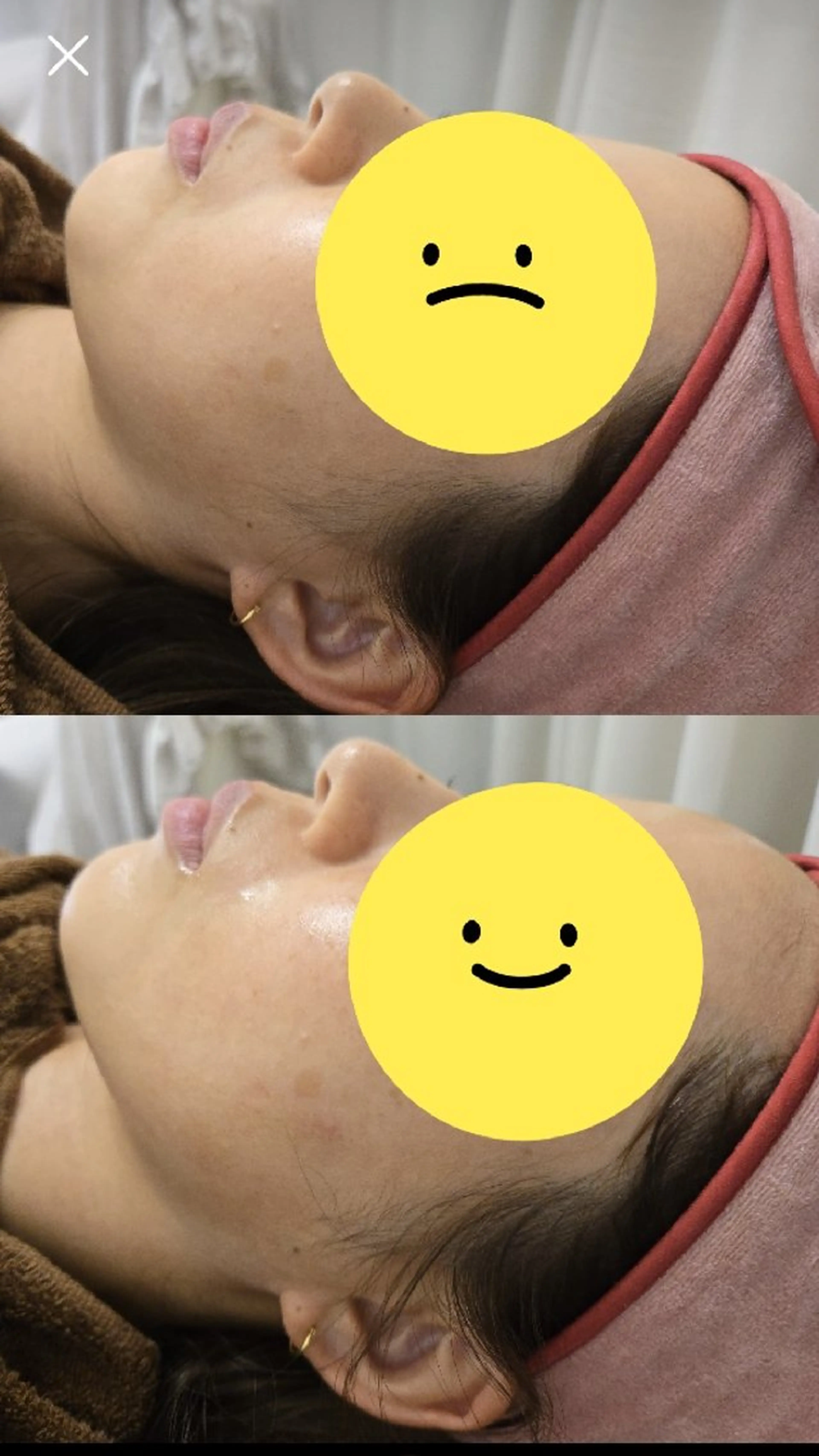 サーマトリックス DTなし💆♀️の写真