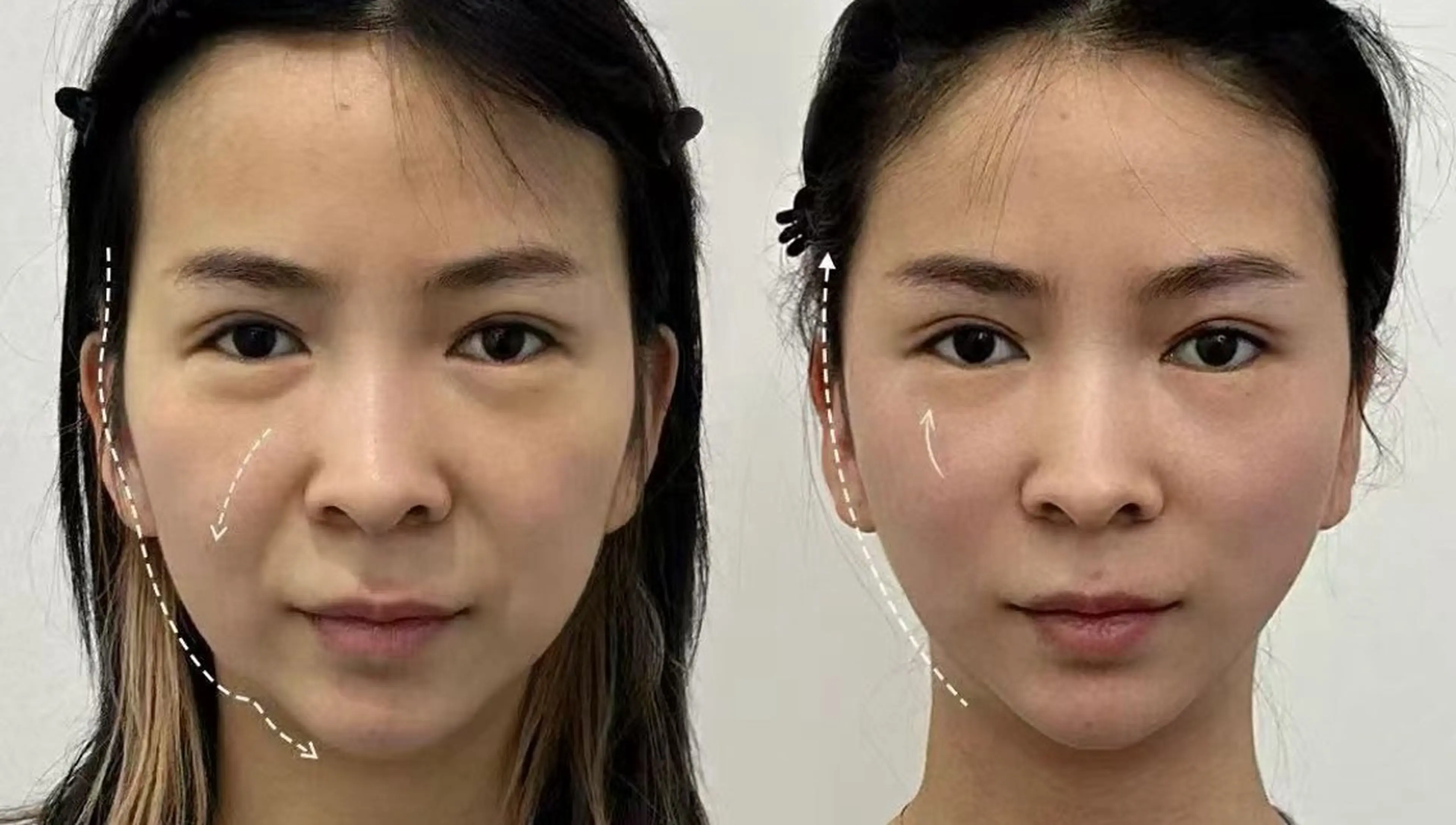 ネイル エステ aliaハイフ&水光ジェットサロン所属・aliaハーブ水光店 エステティシャン募集のエステ・リラクイメージ