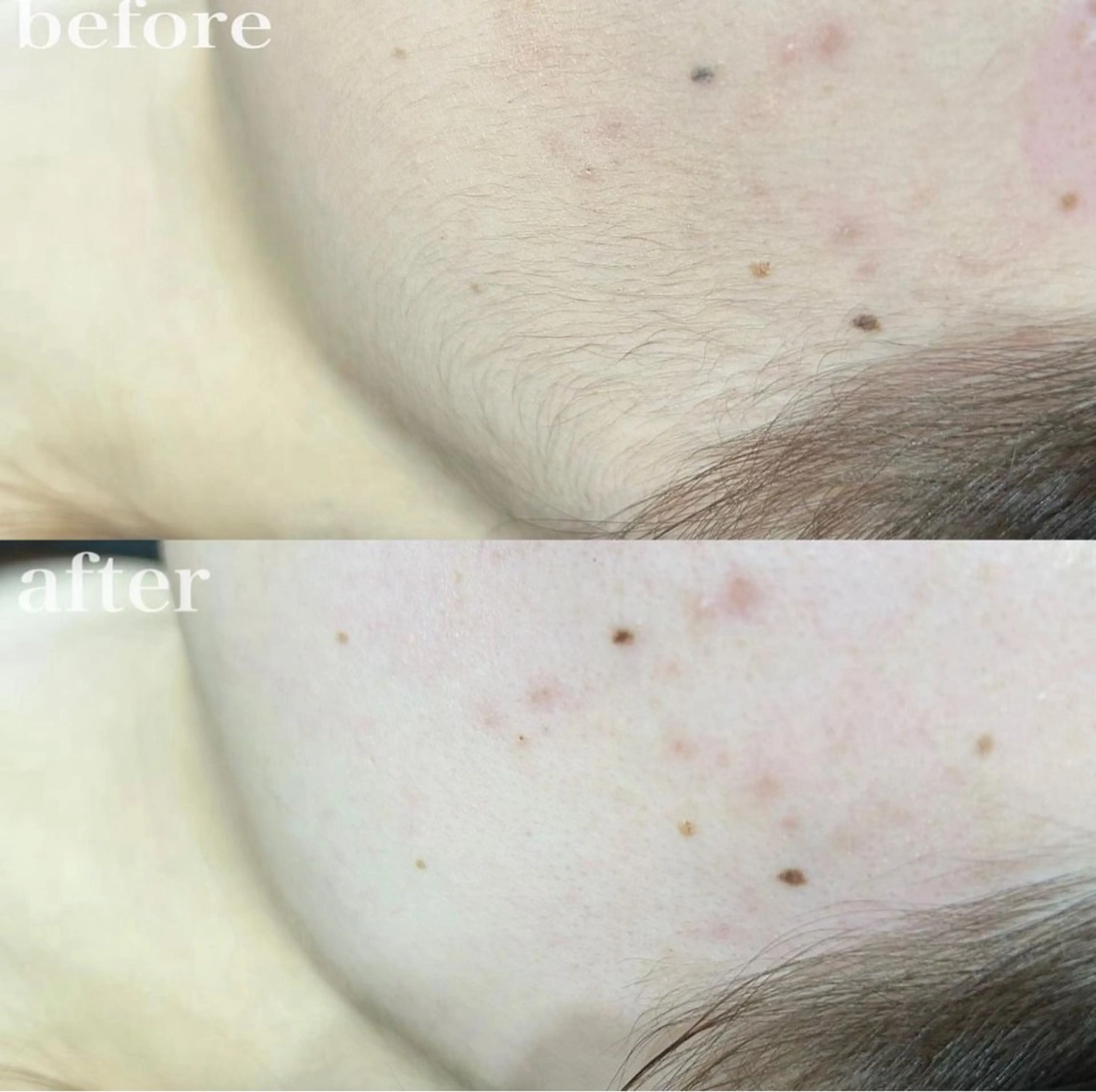 アイブロウ ハリウッドブロウリフト メンズアイブロウ 眉毛ワックス脱毛 Lnature 【完全個室】熊本上通の眉毛・アイブロウイメージ