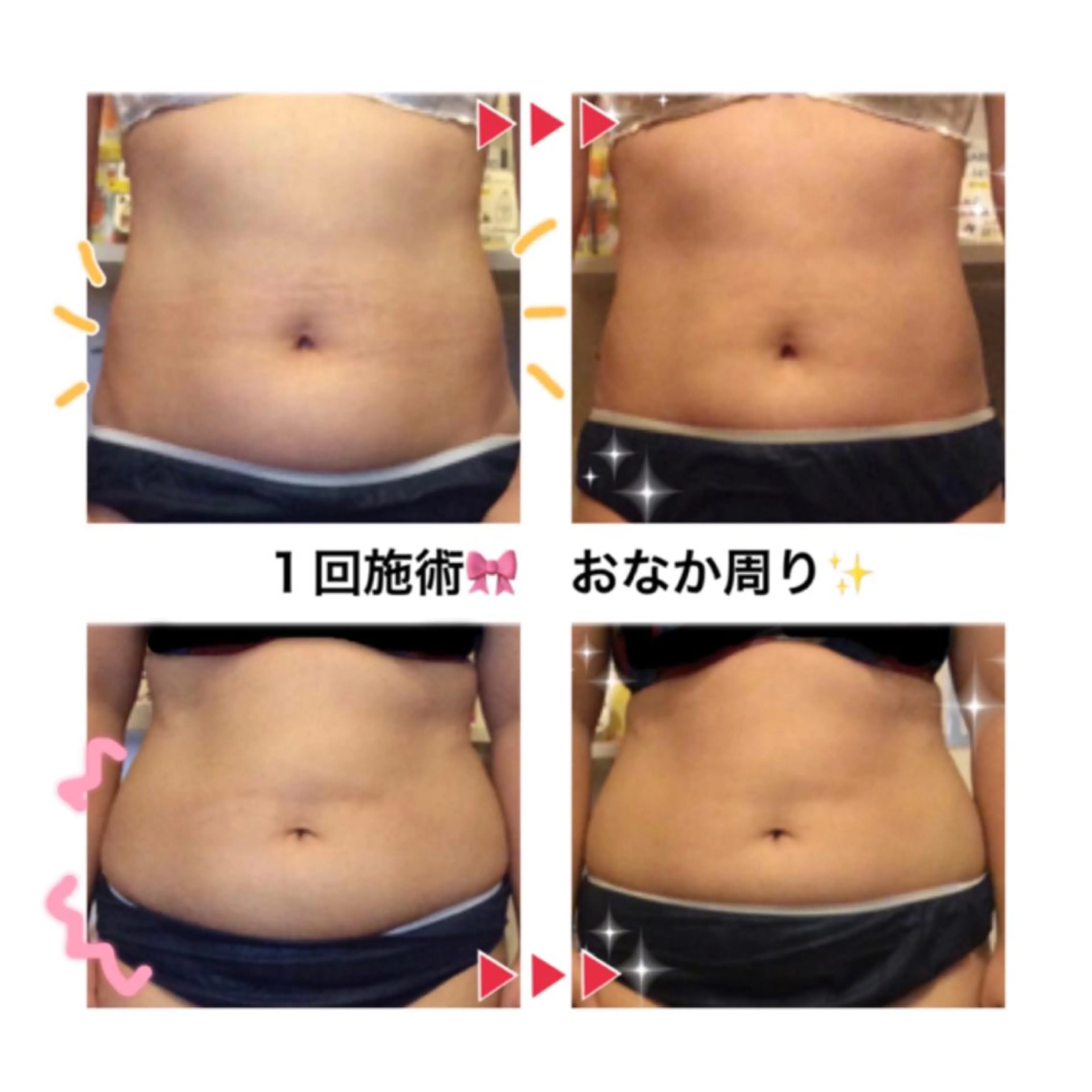 エステ リラク ダイエット・美肌ケア fleurのエステ・リラクイメージ