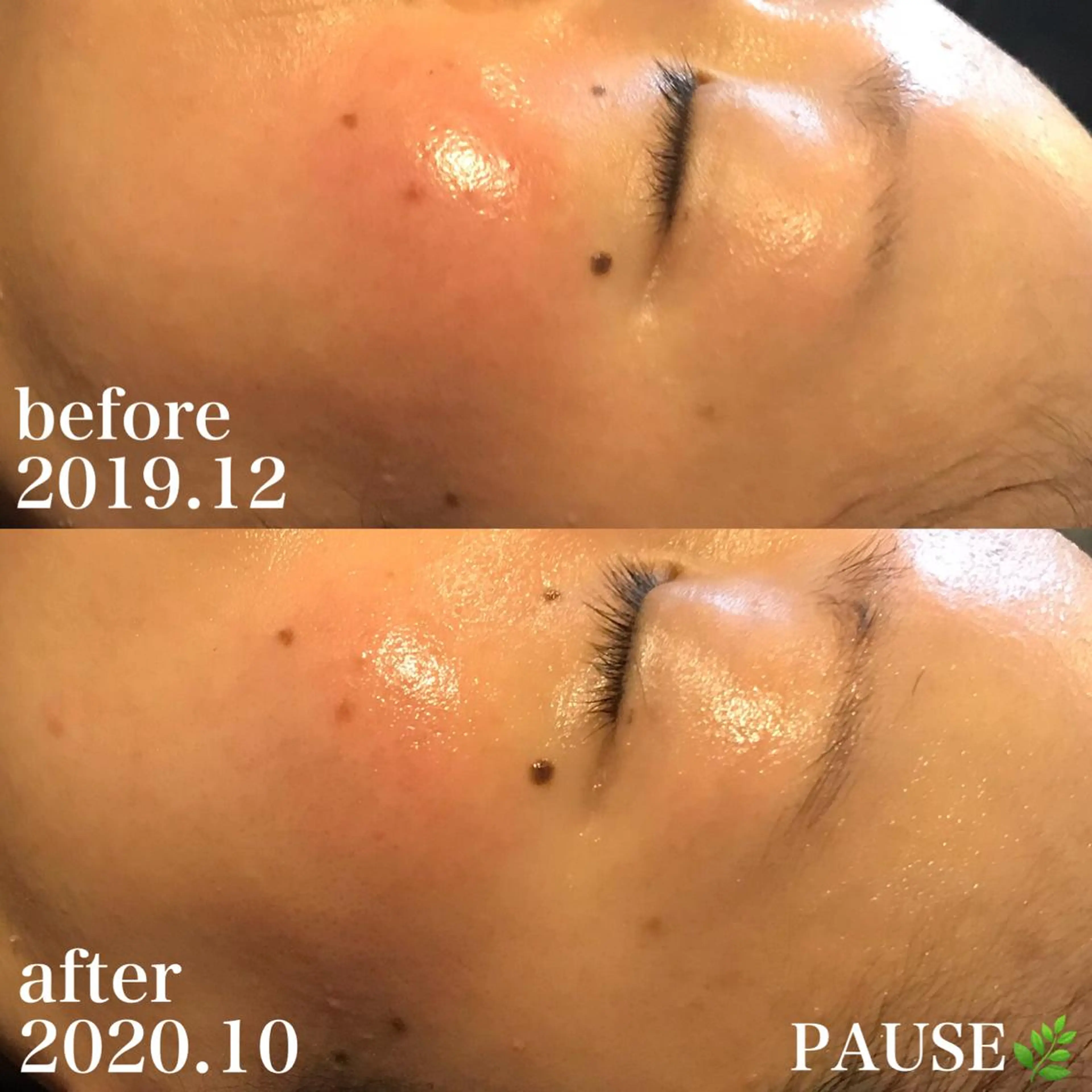 エステ リラク 浜野 恵美のエステ・リラクイメージ