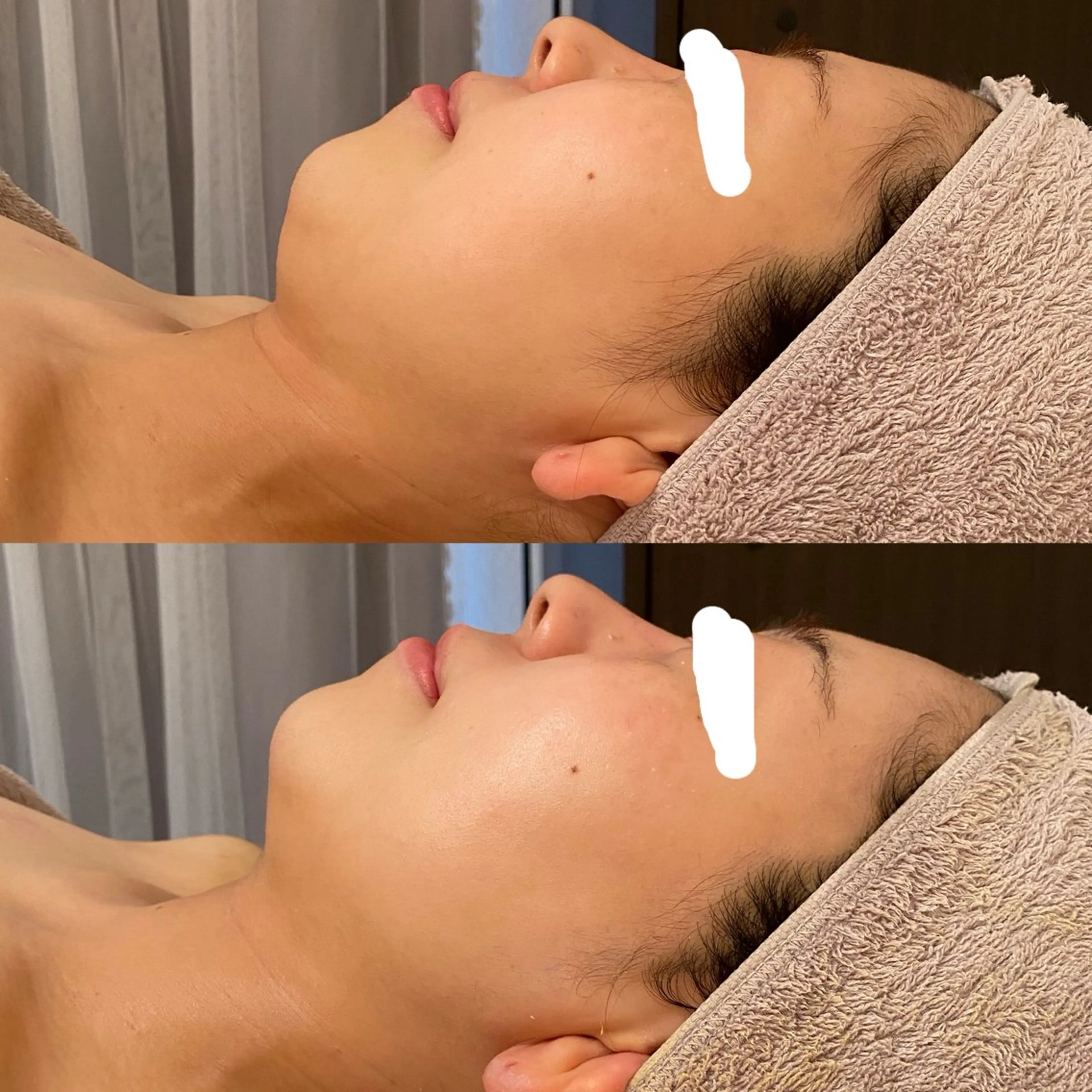 エステ リラク 田中For..天王寺 肌質改善/よもぎ蒸しのエステ・リラクイメージ