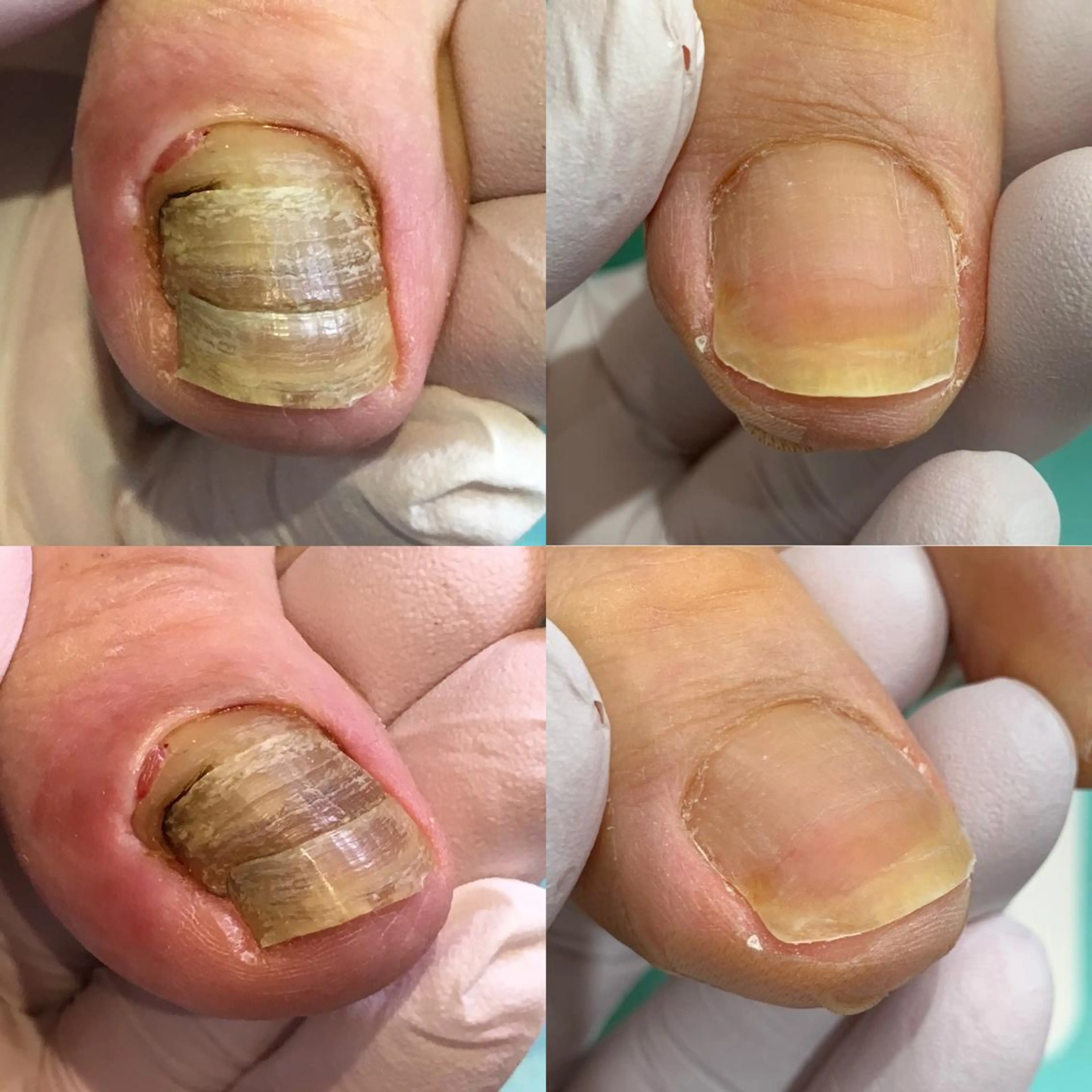 ネイル 東京巻き爪アカデミー所属・東京巻き爪 アカデミーのエステ・リラクイメージ