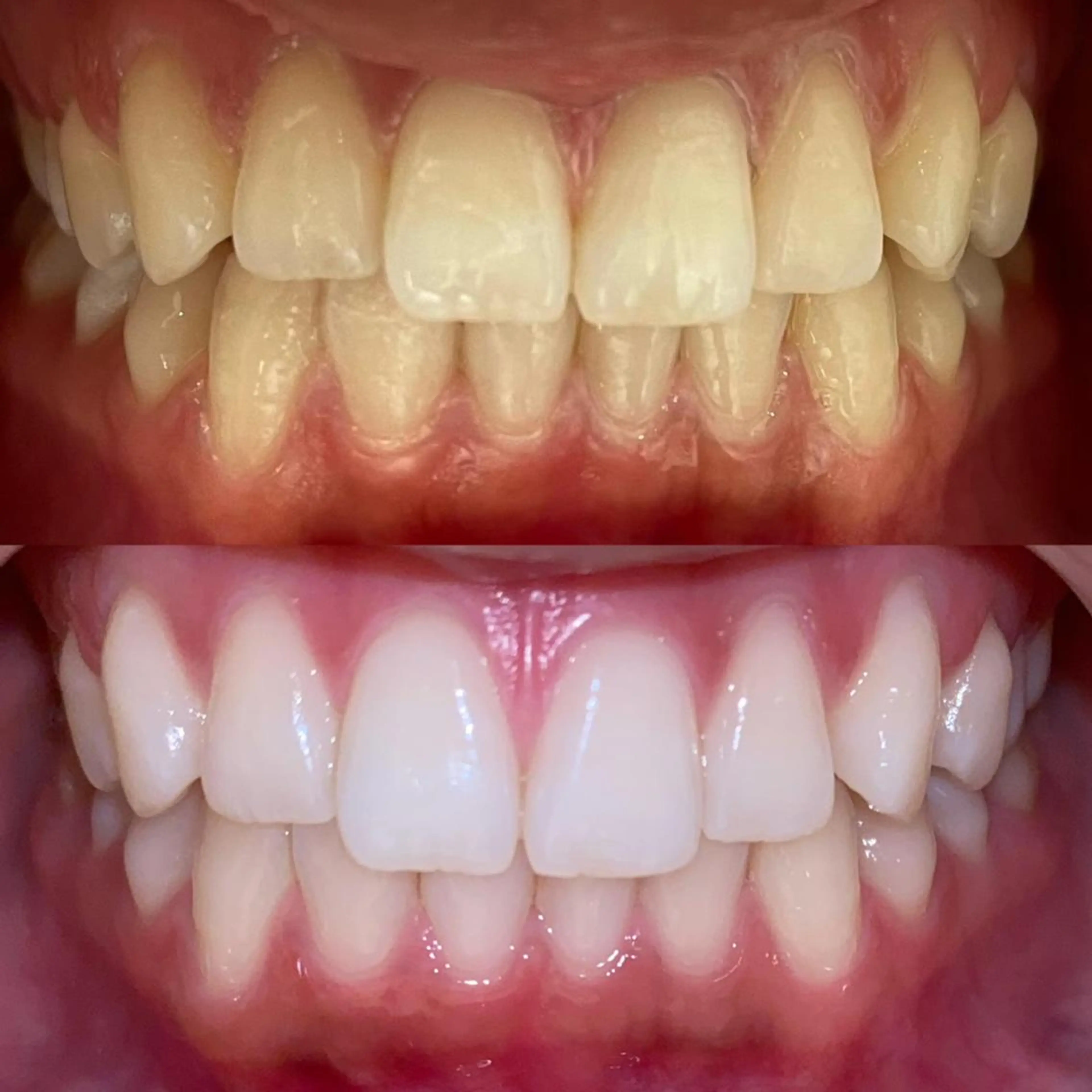 その他 栄 VIO Rのエステ・リラクイメージ