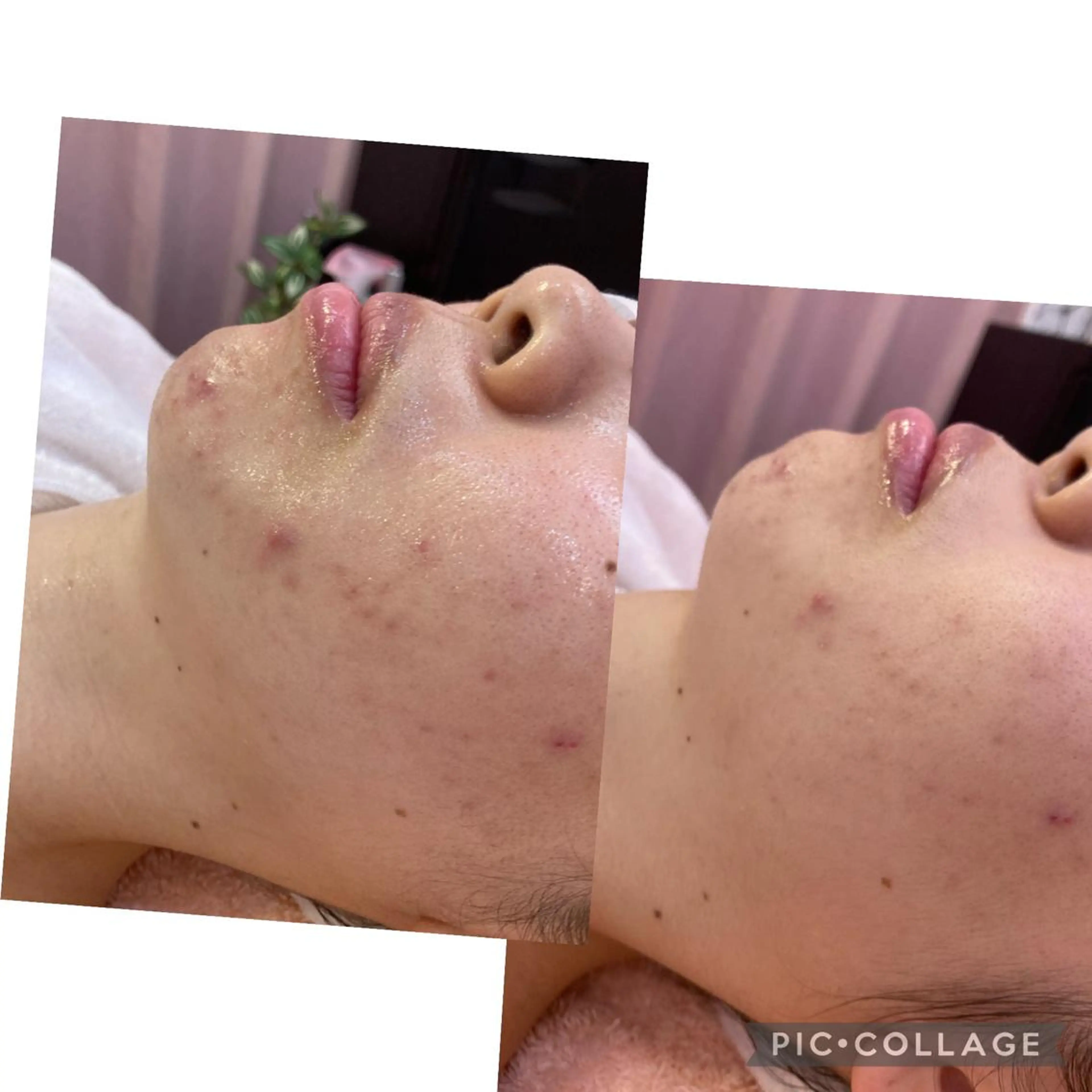 九鬼 瞳のエステ・リラクイメージ