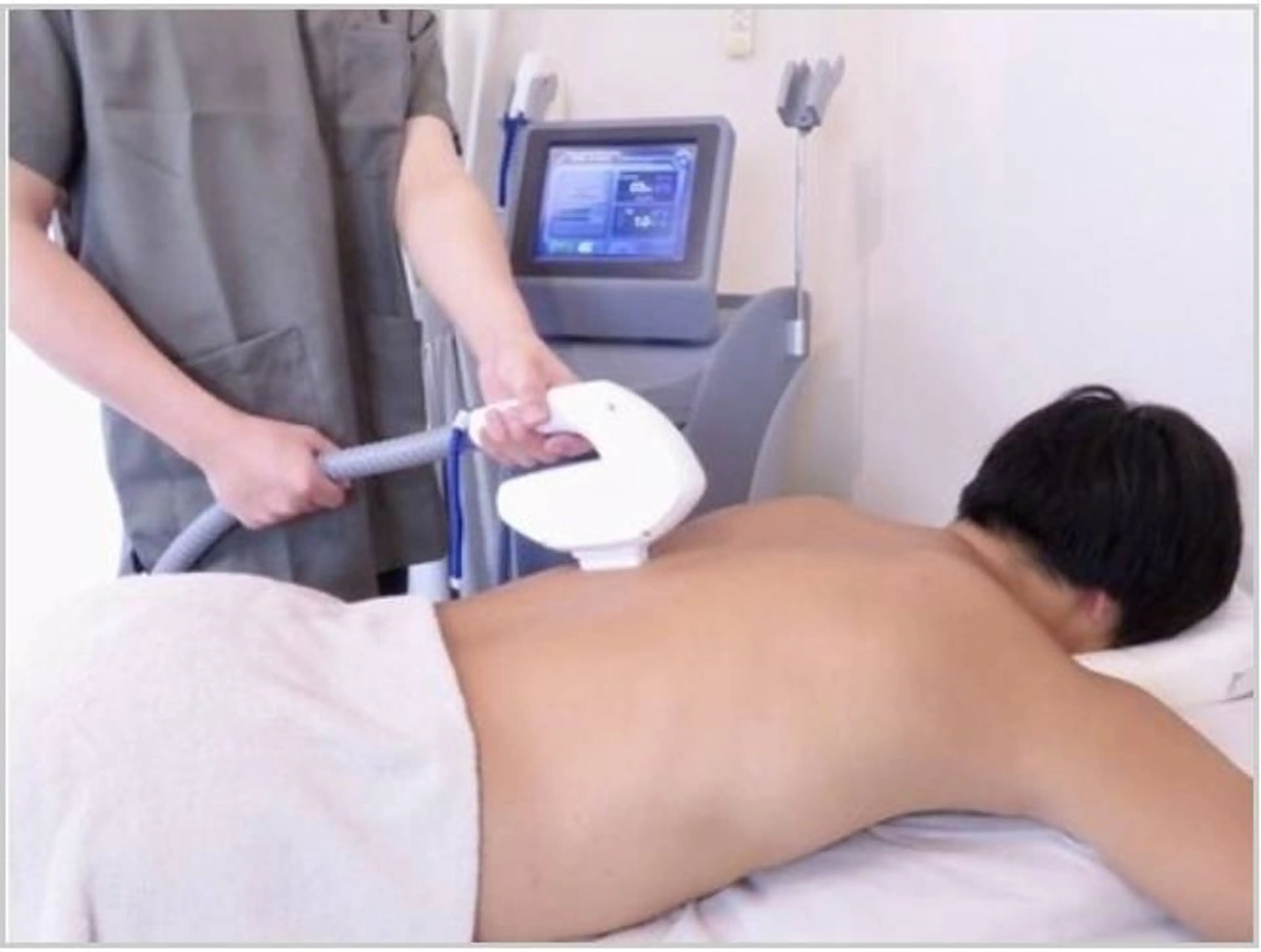 男性全身脱毛(髭+VIO込み)の写真