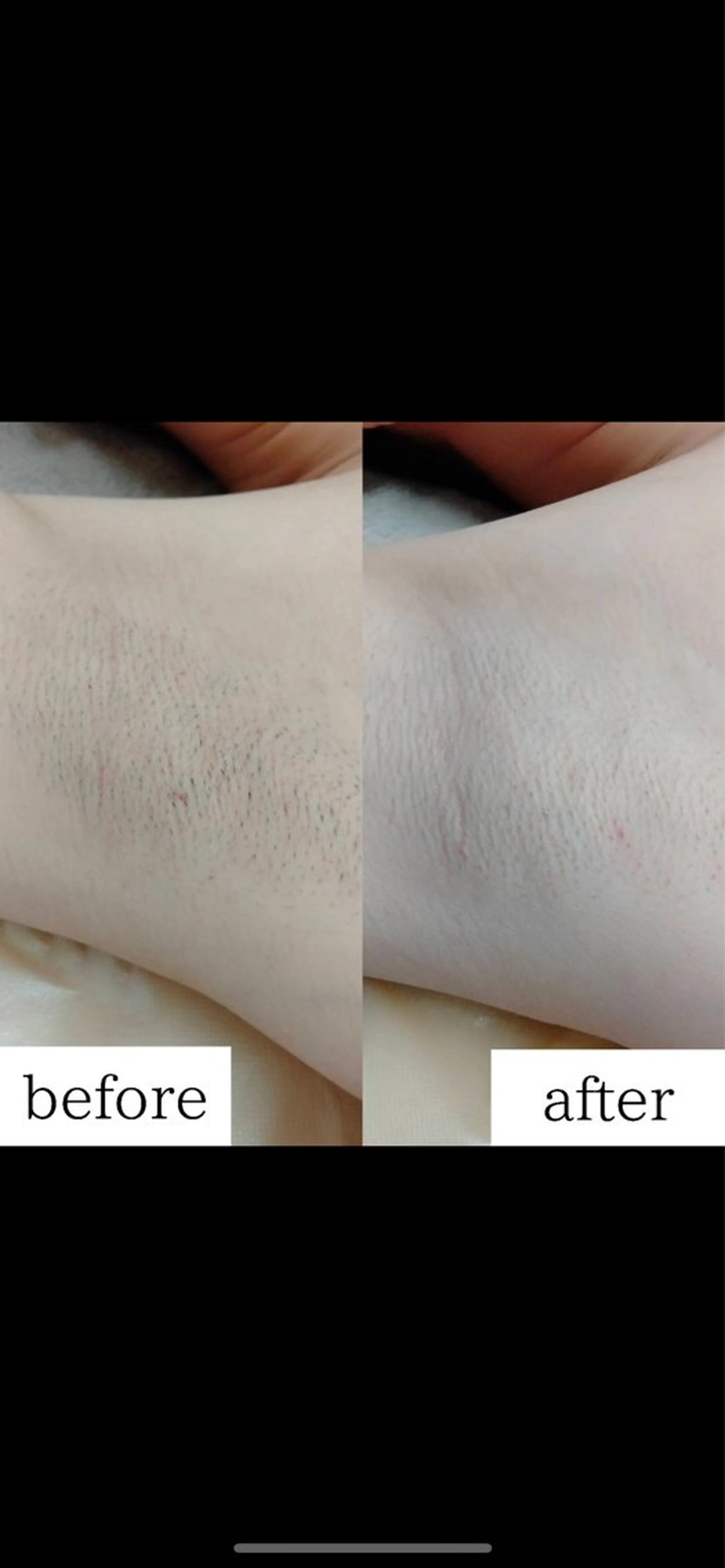 メンズ キッズ みんなの脱毛 TSURURINの眉毛・アイブロウイメージ