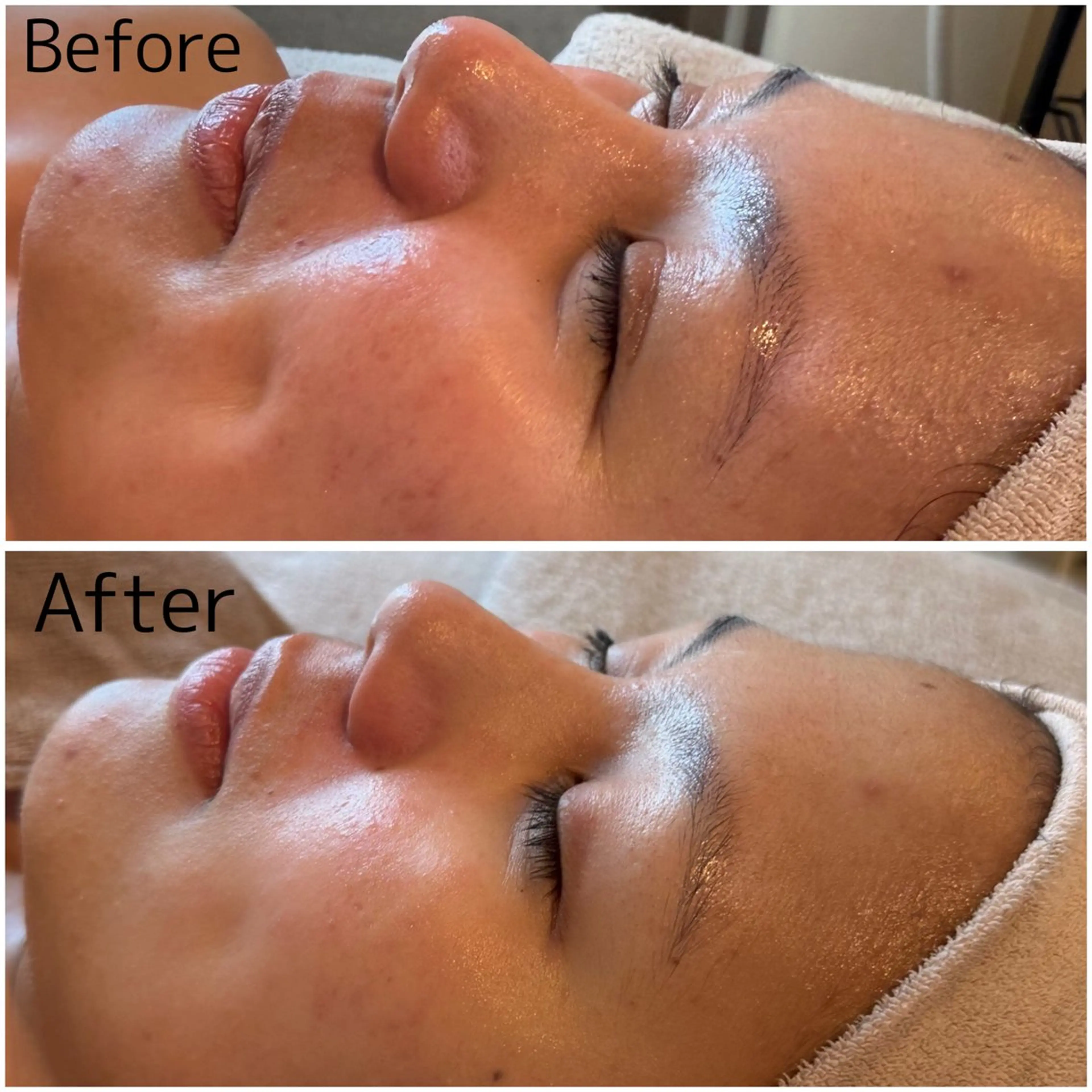 MiEL total beauty salon所属・脱毛サロン MiELのエステ・リラクイメージ