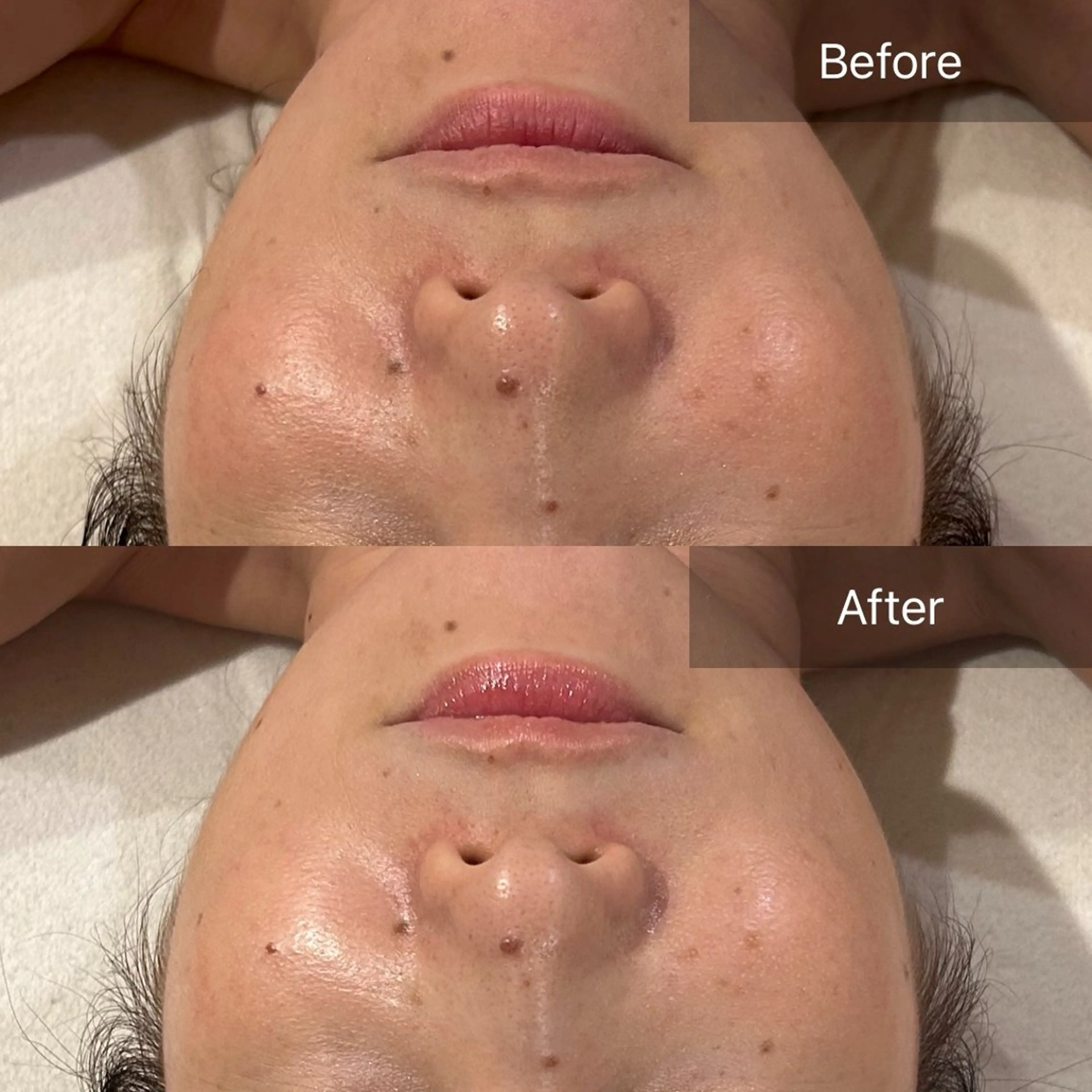 エステ clé skin 🌿ハーブピーリングのエステ・リラクイメージ