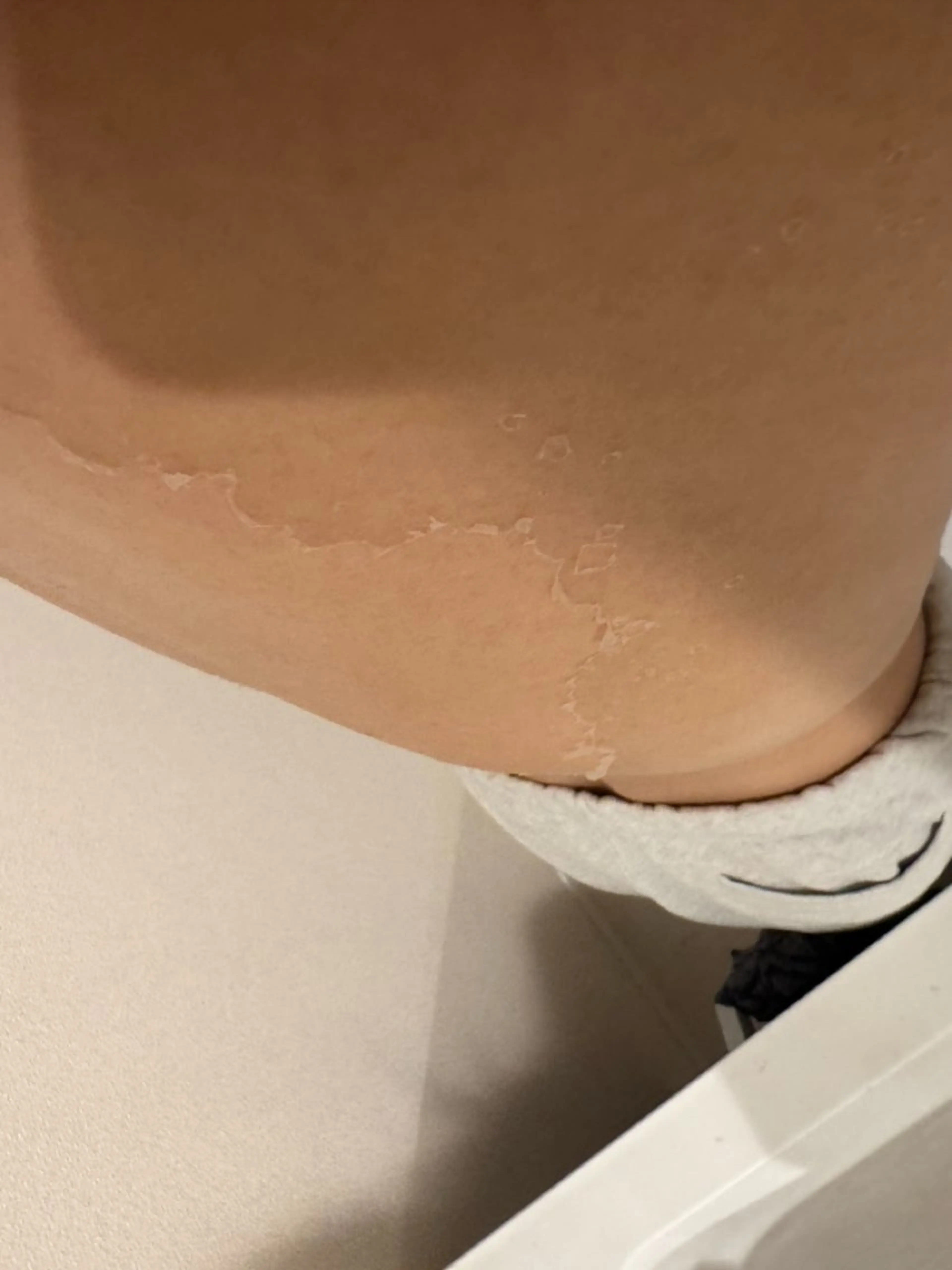 エステ clé skin 🌿ハーブピーリングのエステ・リラクイメージ