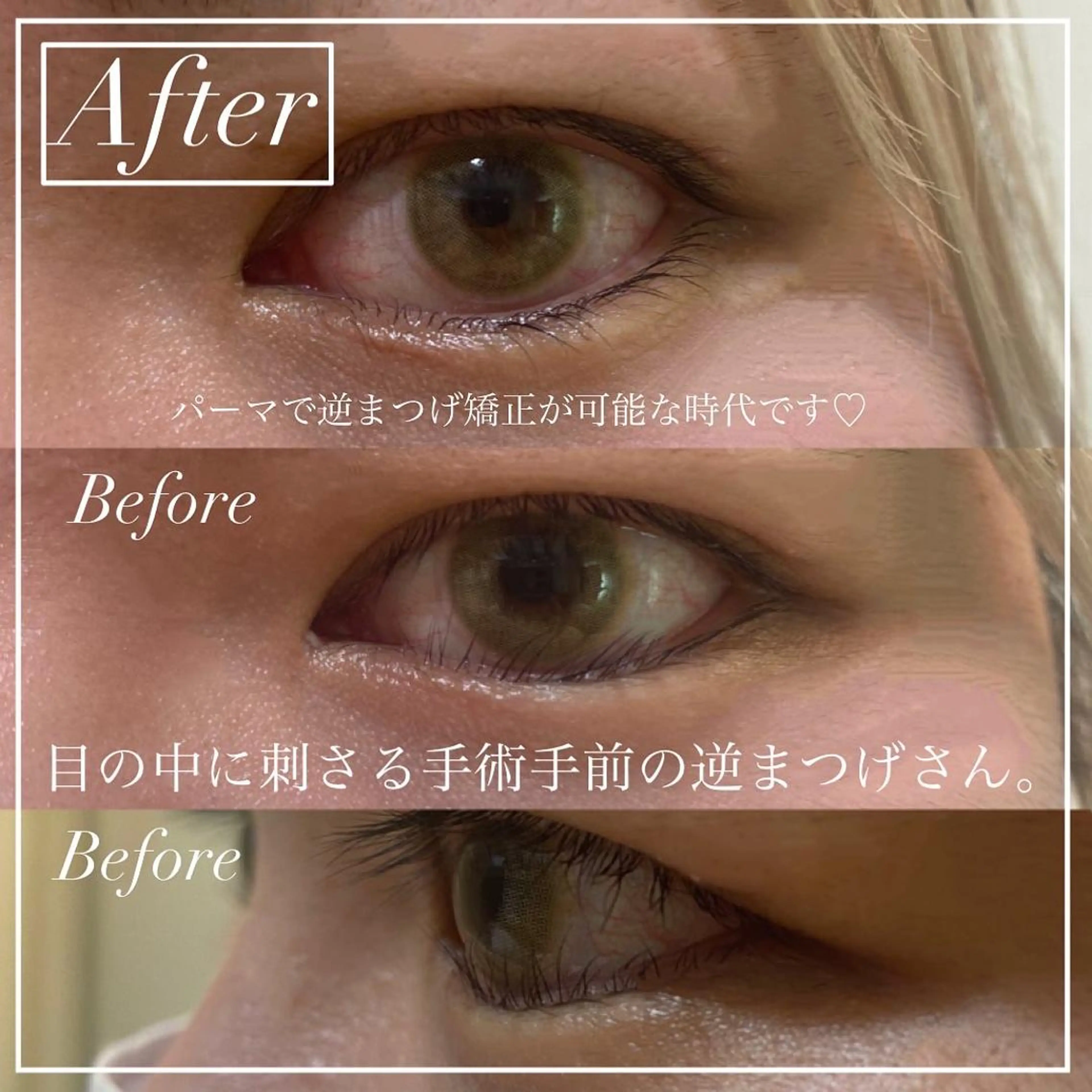 マツエク・マツパ マツパ kurogi nanakaのネイルデザイン