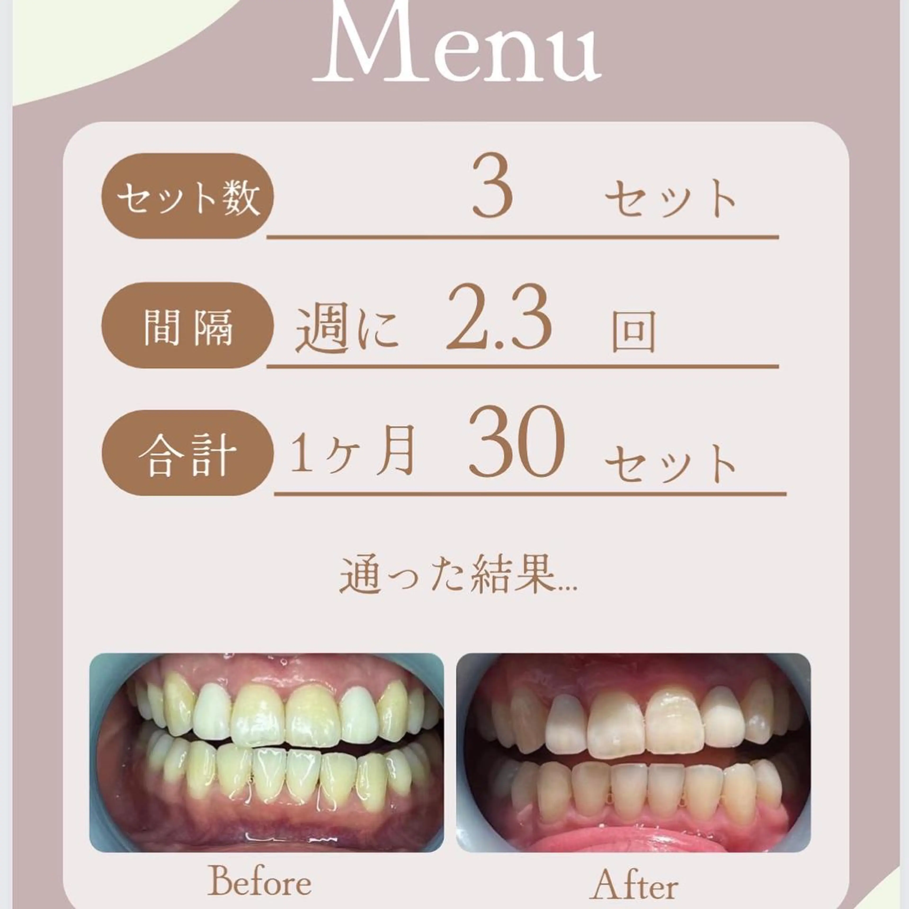 LAVISH nail salonのネイルデザイン