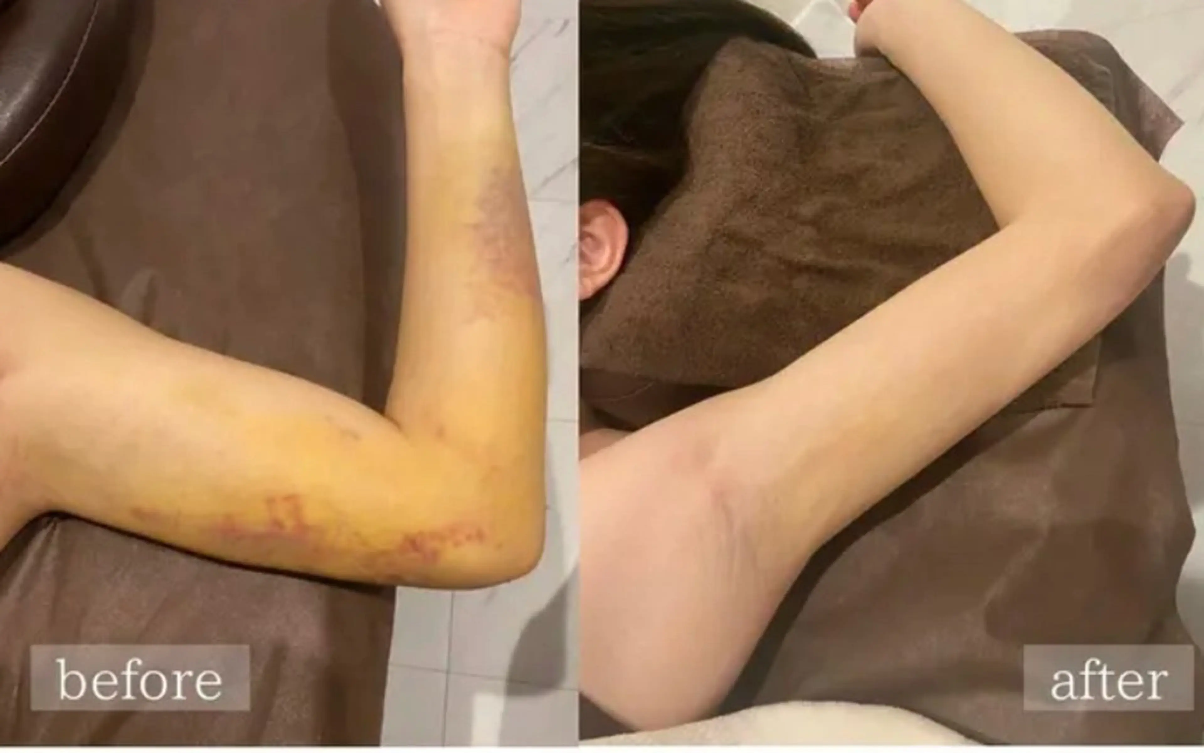 術.後ケア60分の写真