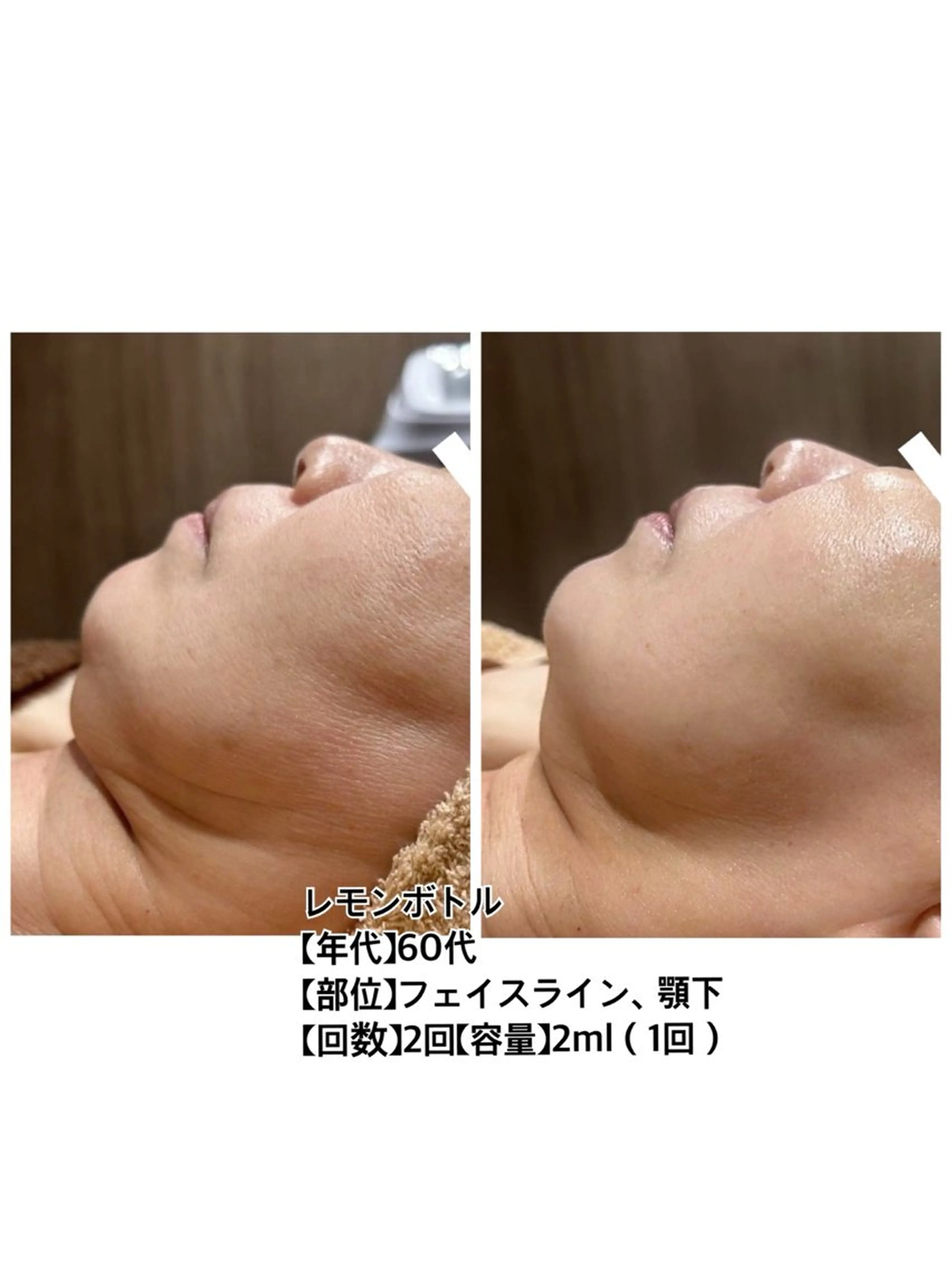 二重アゴ撃退！フェイスラインすっきり小顔ケア🔥の写真