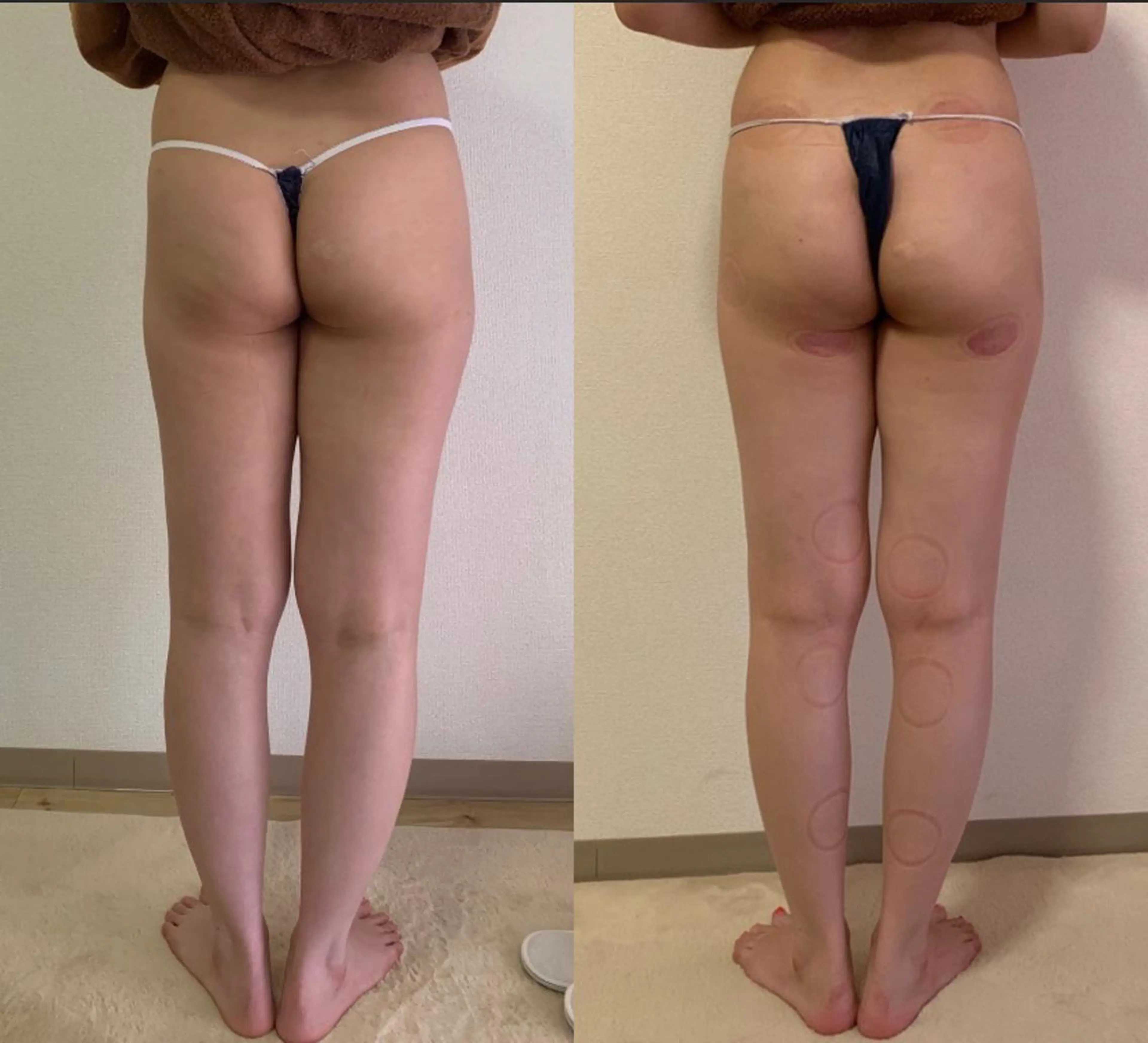 a  room salonのエステ・リラクイメージ