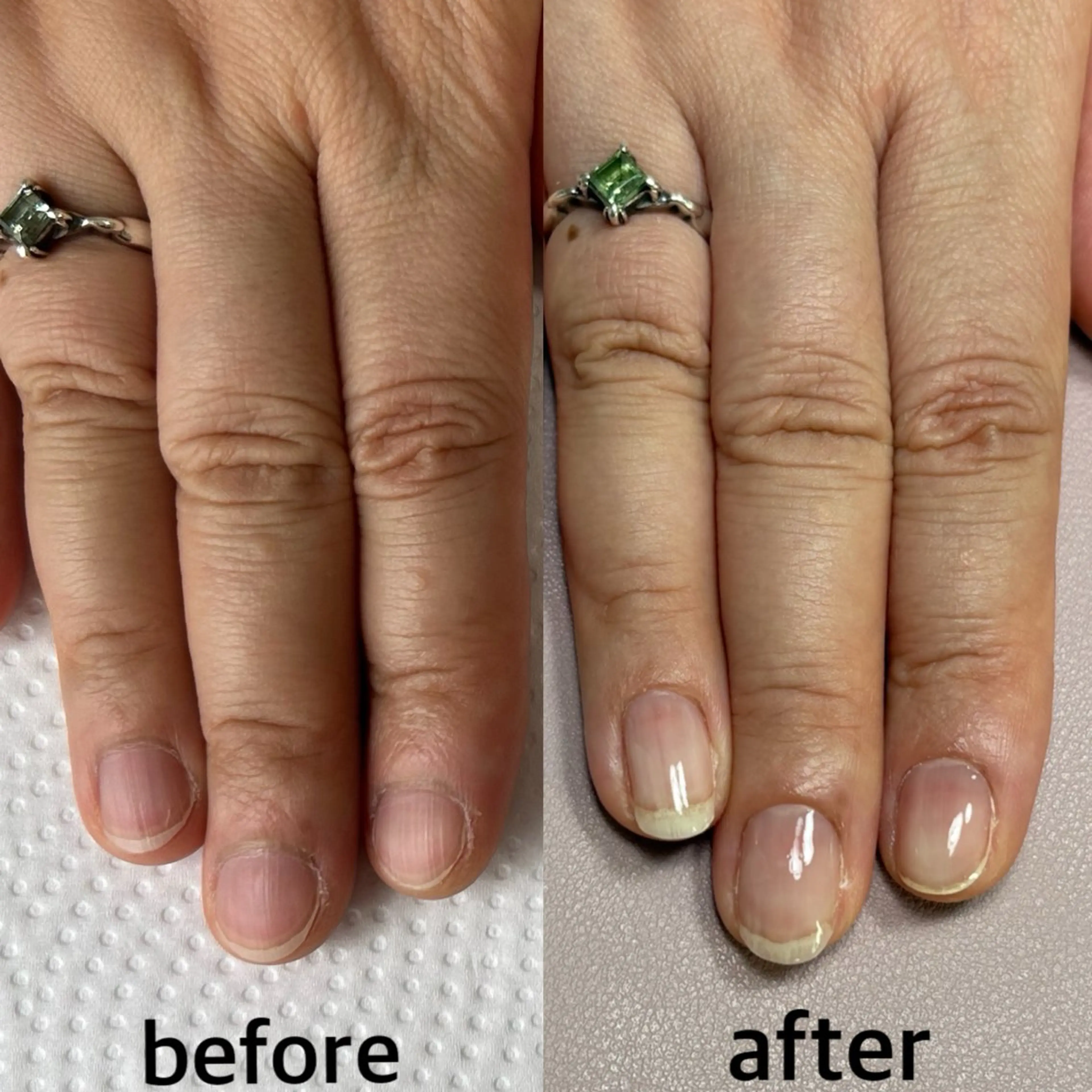 ジェルを使った自爪育成３回コースの写真