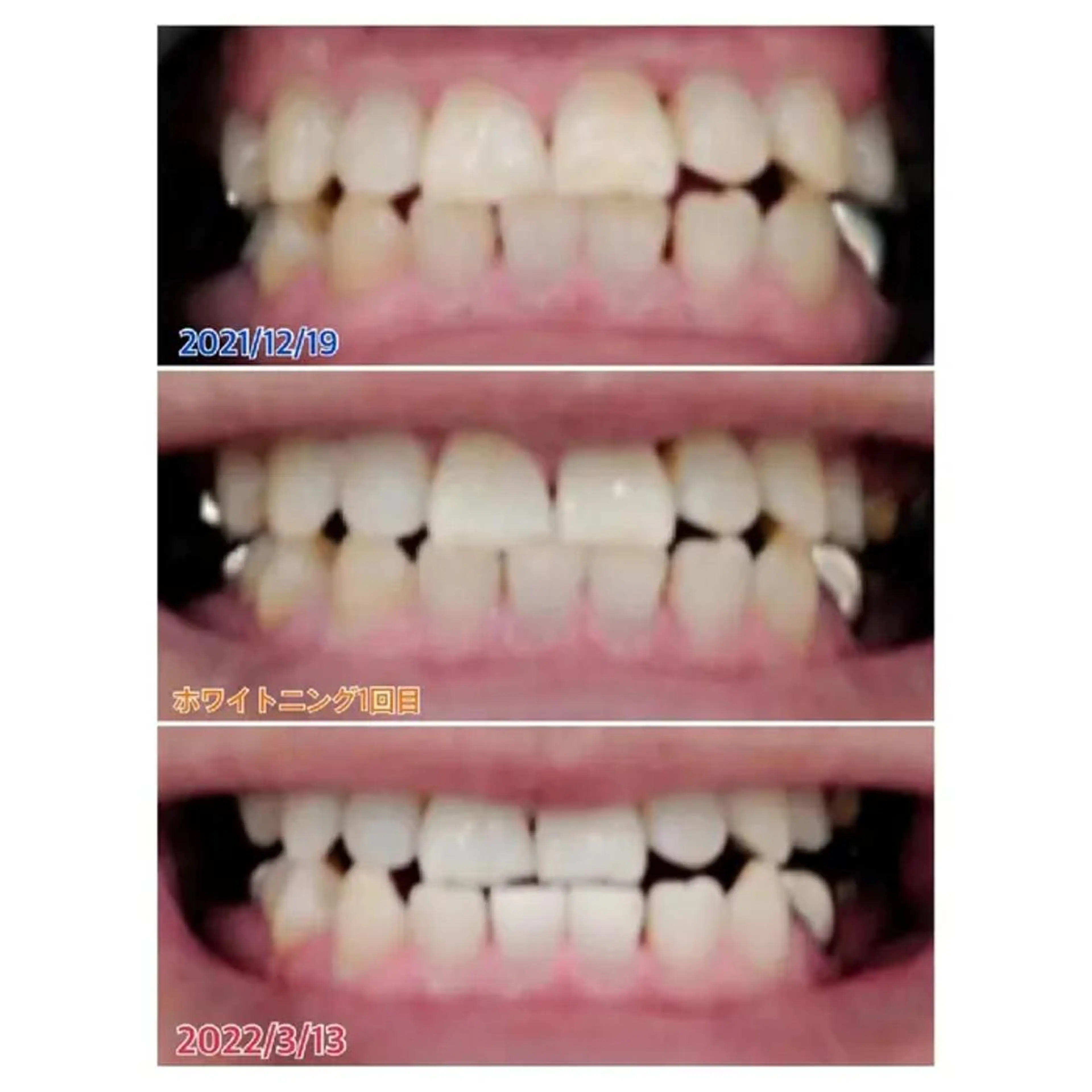 M渋谷店所属・Ｍ渋谷 ホワイトニングのその他イメージ