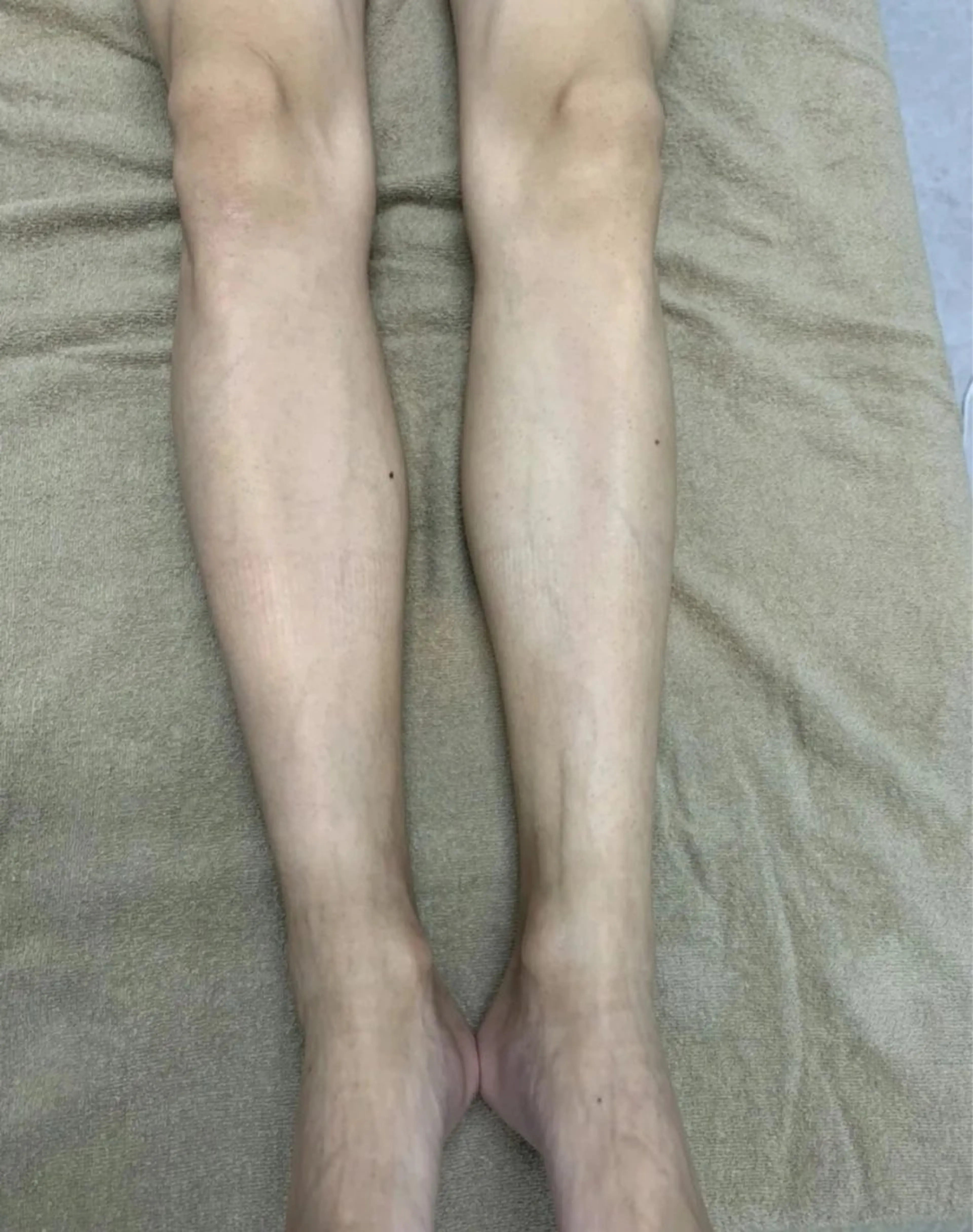 脱毛 脱毛サロン　　　ベル・マタン所属・脱毛サロン ベル・マタンのエステ・リラクイメージ