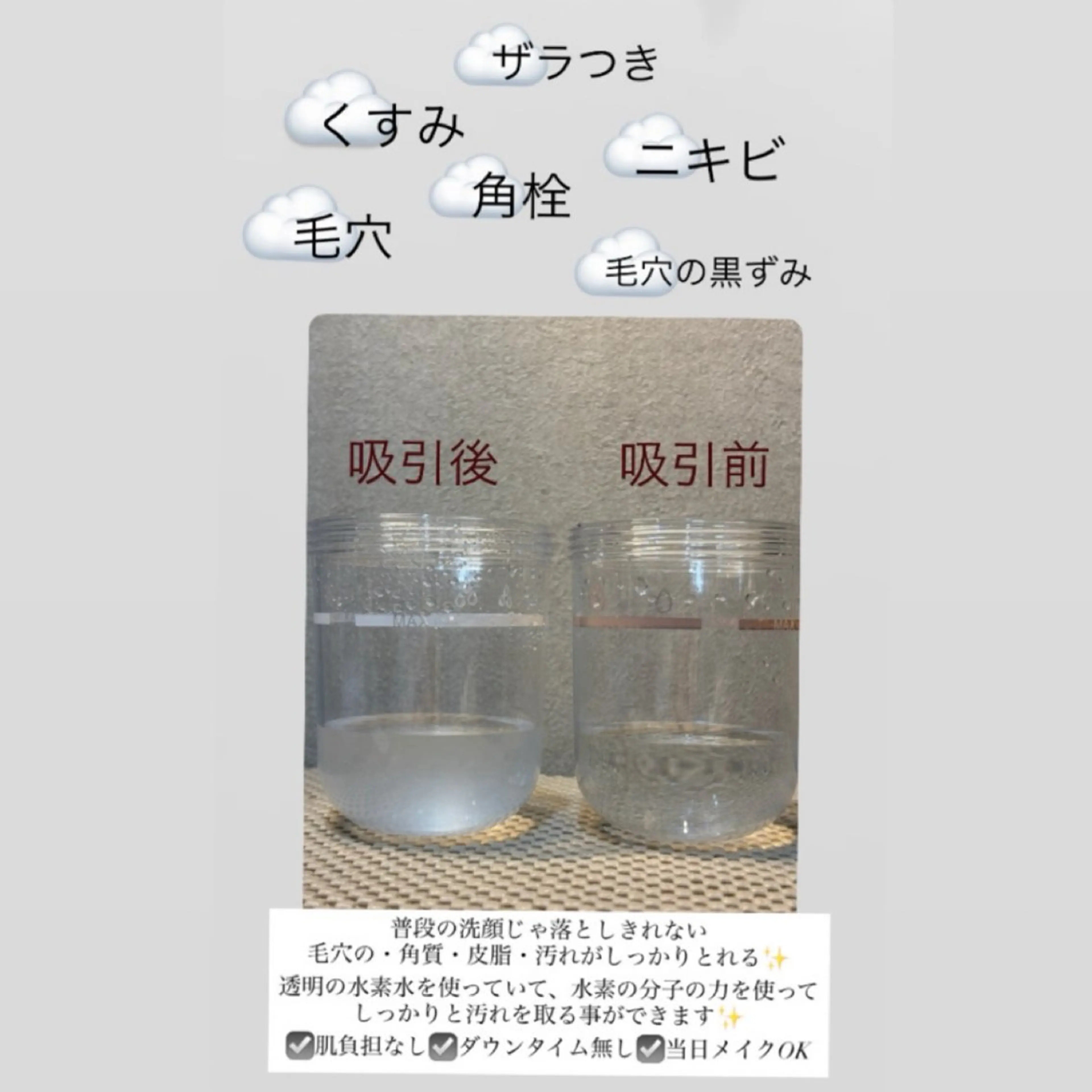 エステ atelier Bellemu所属・【錦糸町】アイブロウ リスト🌷ホノカの眉毛・アイブロウイメージ