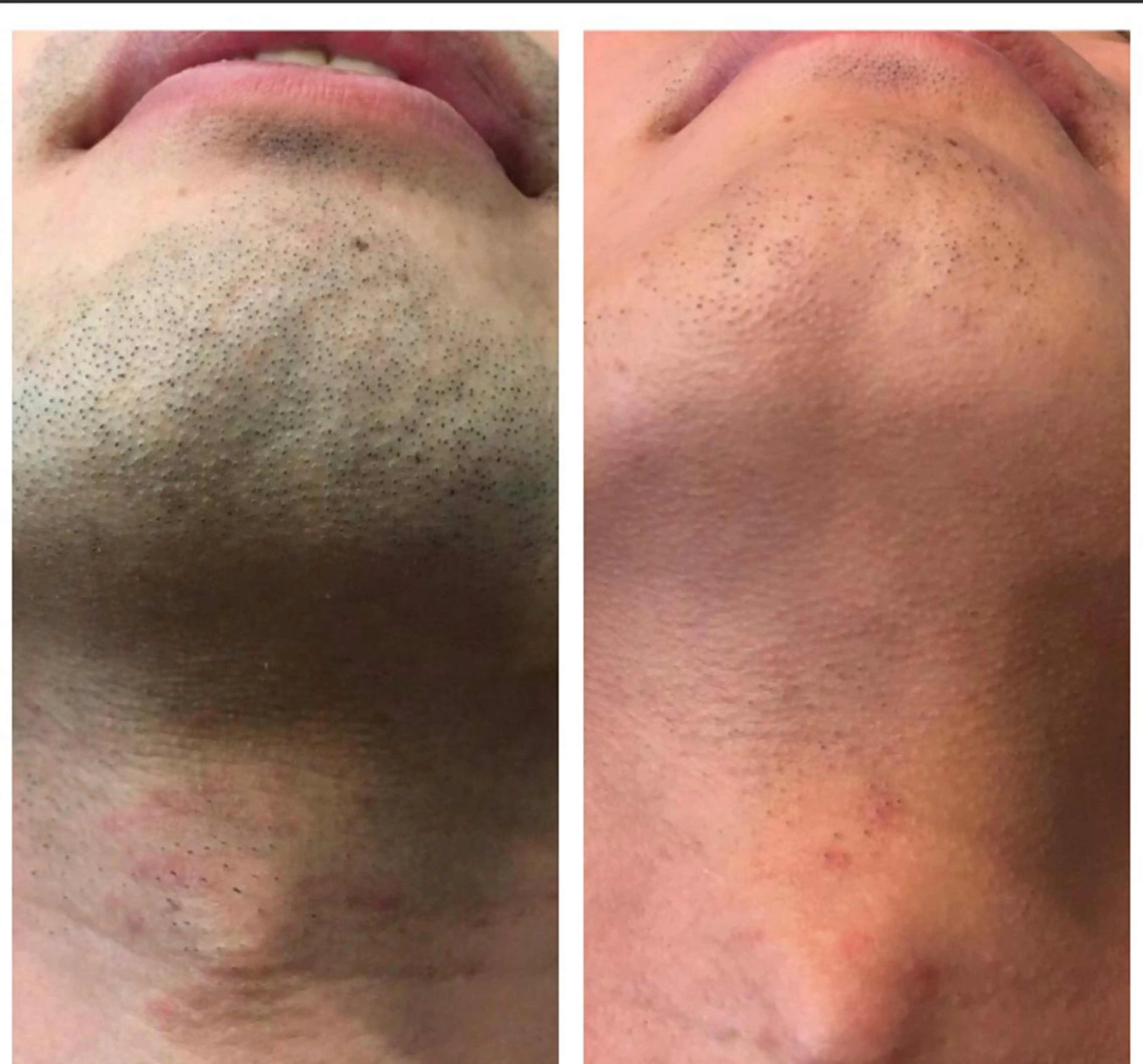 メンズ INFINITY 神戸店のエステ・リラクイメージ