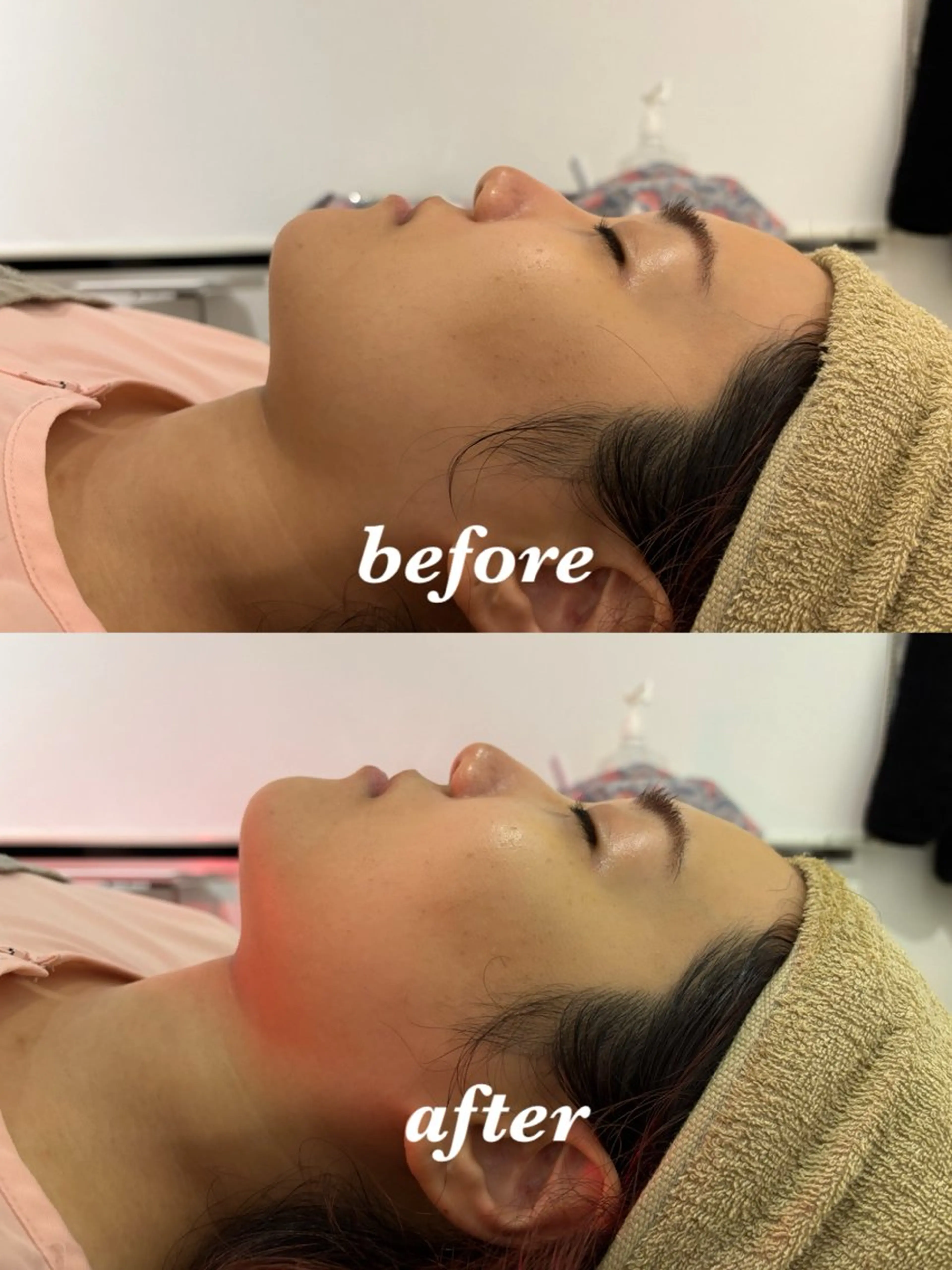 メンズ エステ リラク 腸活サポート みなみののエステ・リラクイメージ