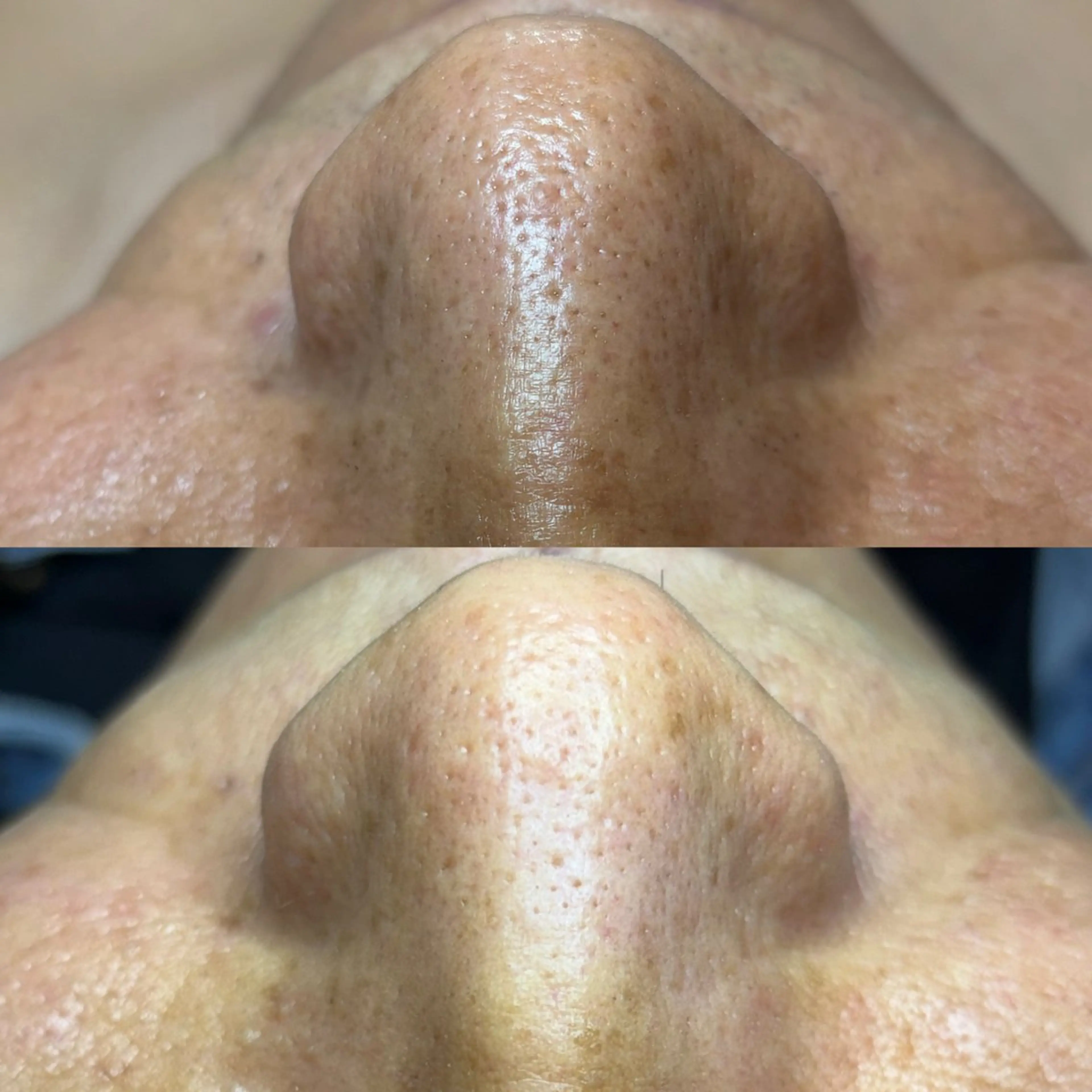 その他 セルフエステエンリケ明石大久保店所属・夕希リンパ&痩身& 脱毛&毛穴ケアのエステ・リラクイメージ